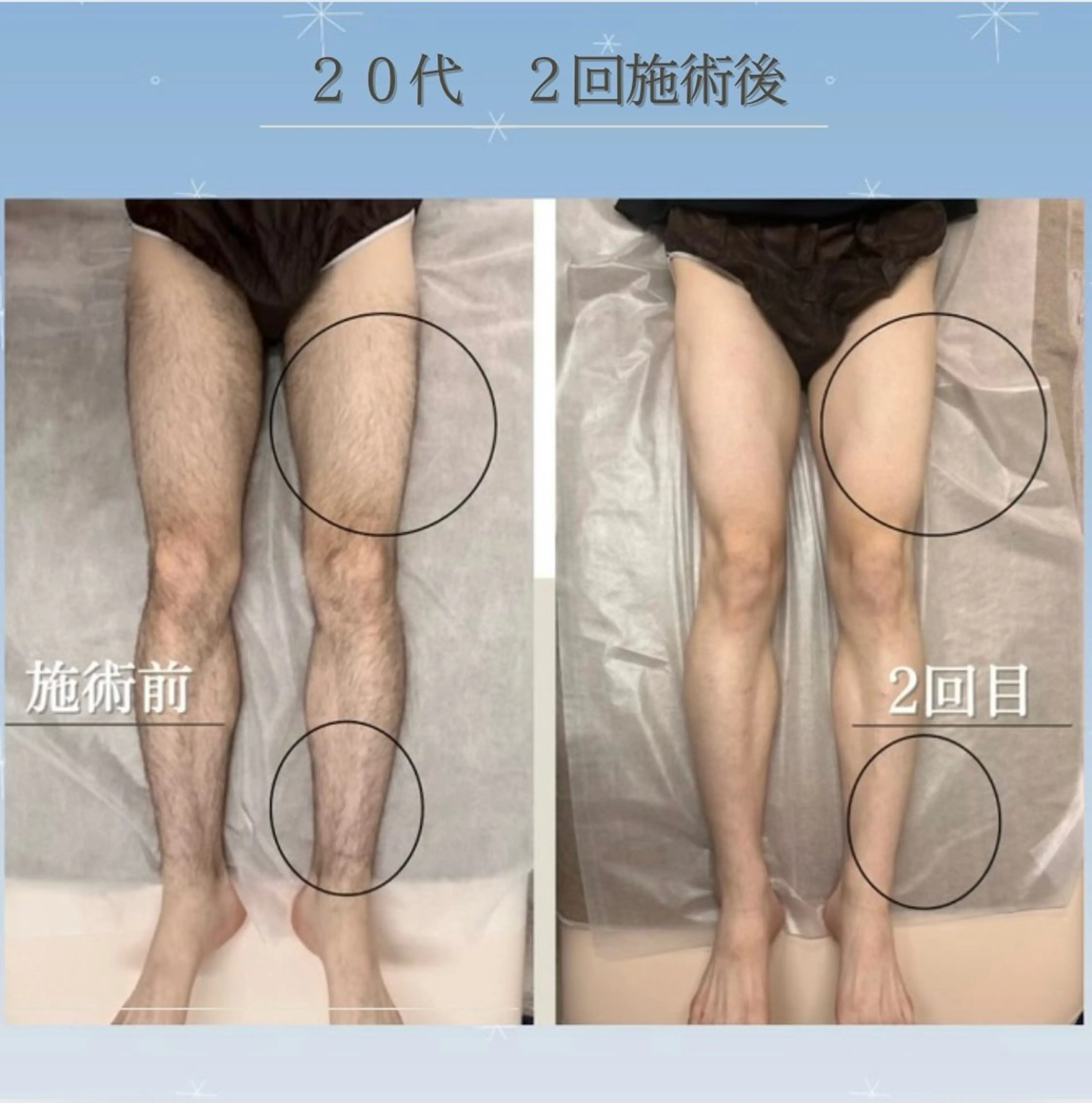 💠the4💠【脱毛特化サロン】所属・LED脱毛サロン 💐ayaのエステ・リラクイメージ