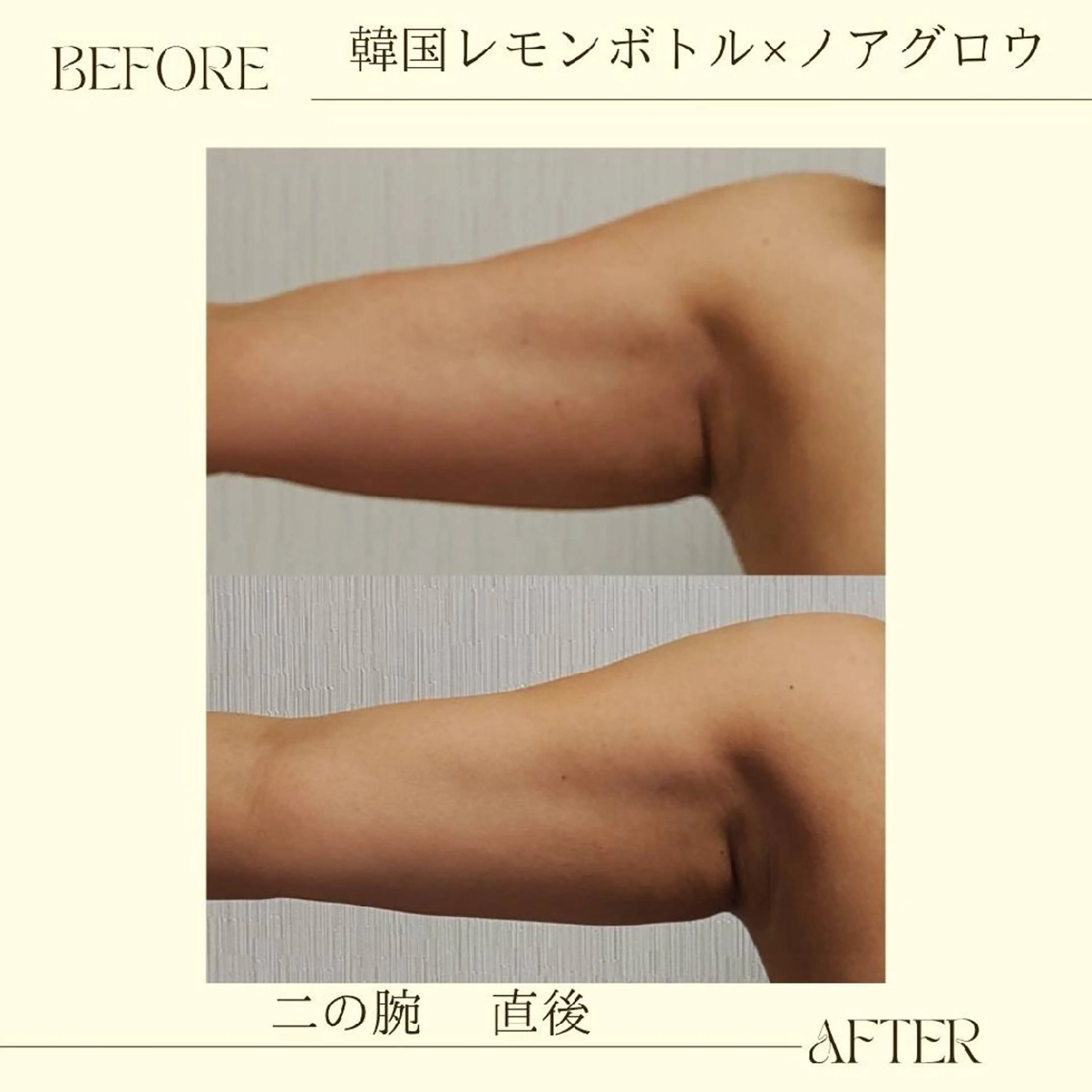 痩身小顔専門 アマテ ビューティー.Nのエステ・リラクイメージ