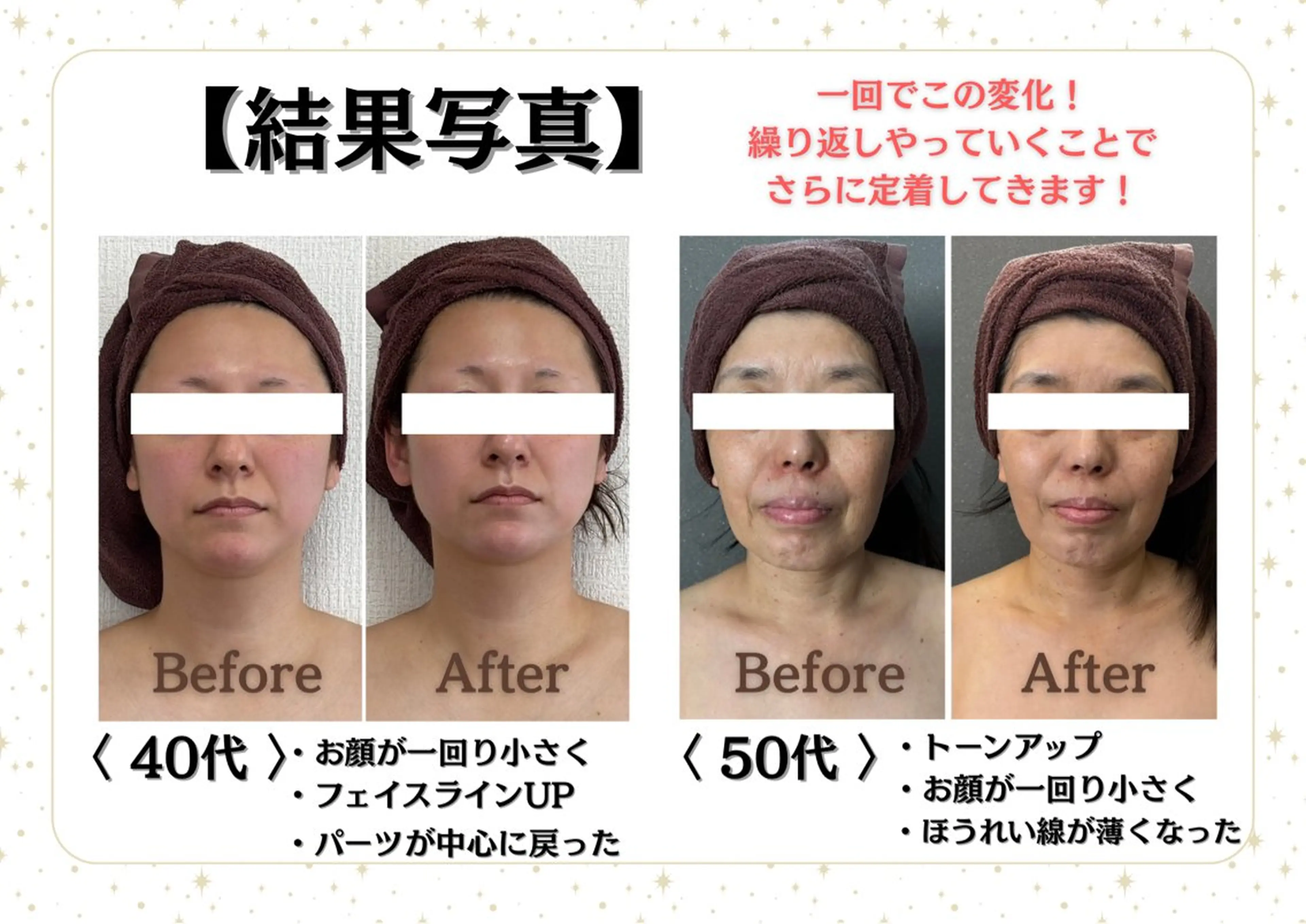 Eminy by  L★sのエステ・リラクイメージ