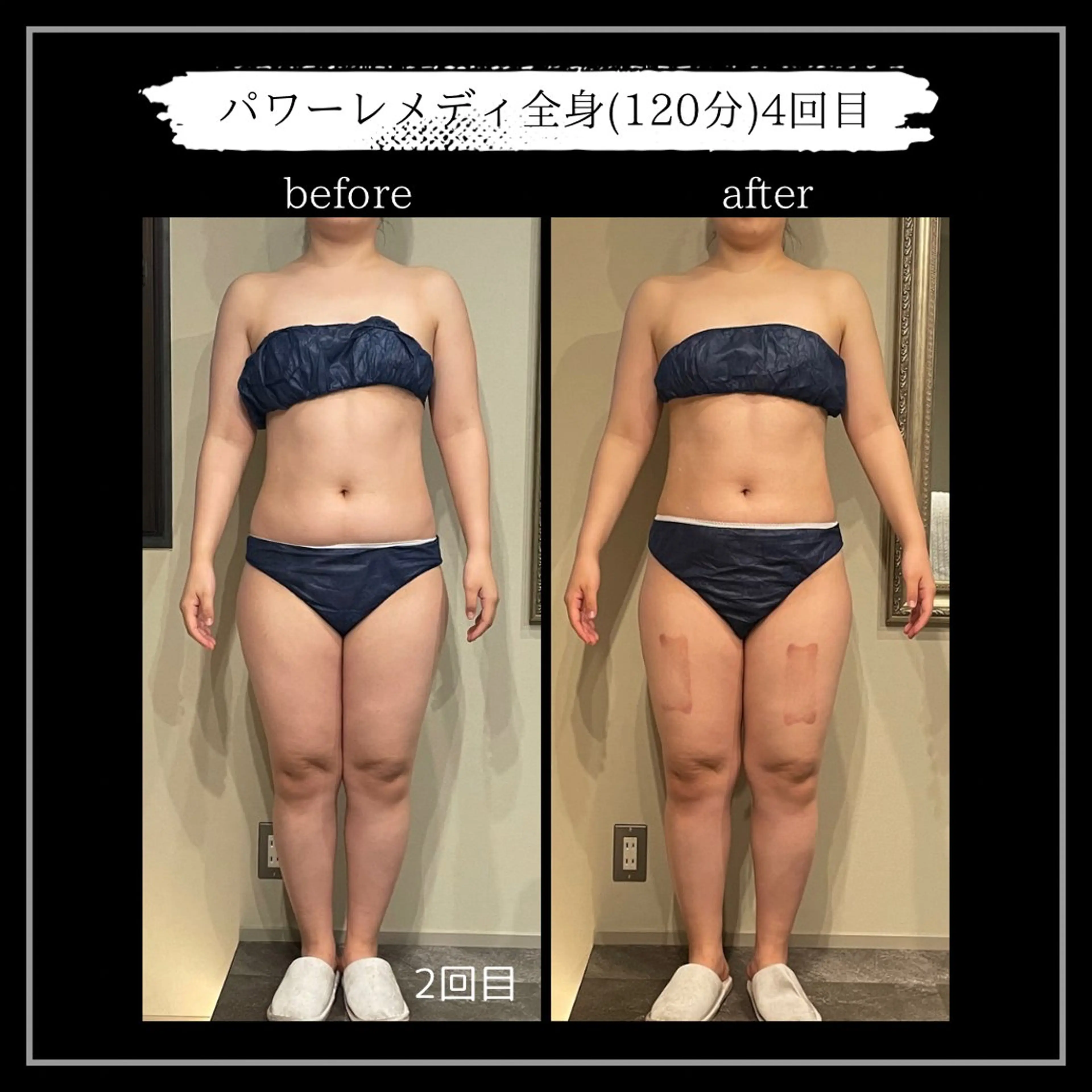 オフ:オン所属・オフ:オン 全身筋膜マッサージのエステ・リラクイメージ