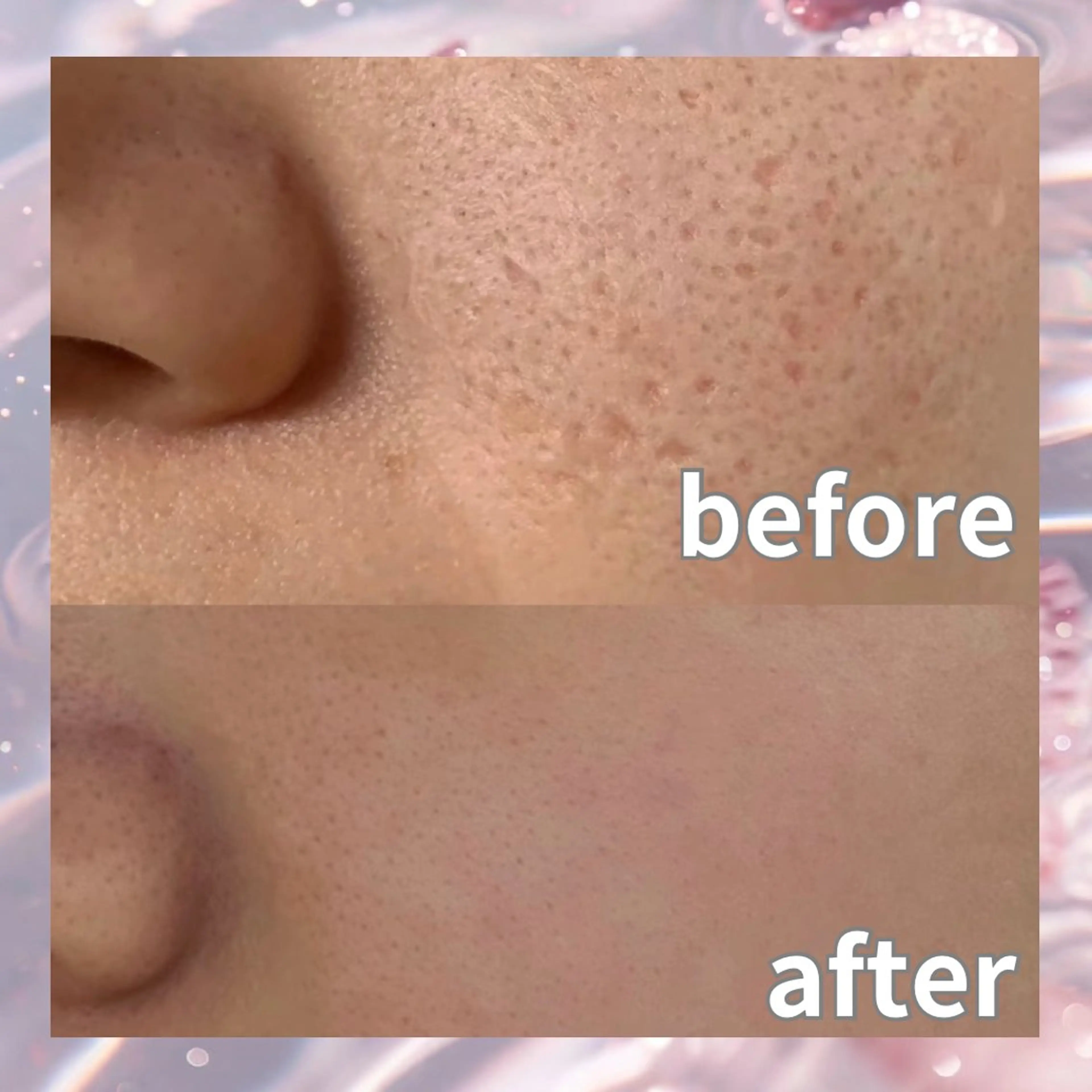 エステ リラク 愛維美水光美肌専門店所属・愛維美水光美肌専門店 メンズレディースokのエステ・リラクイメージ