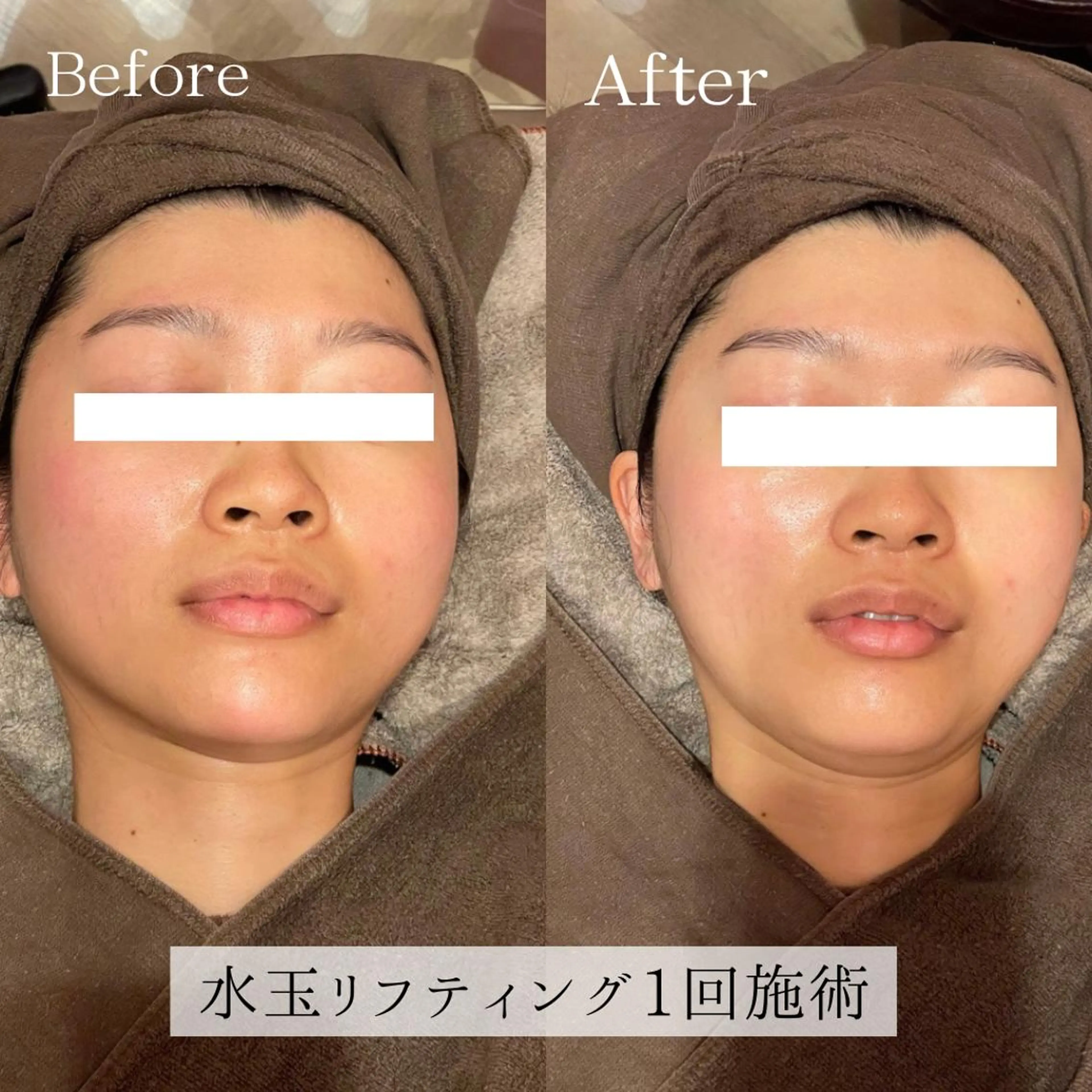 エステ 小顔美肌：ミアンカ 京阪モール本館1Fのエステ・リラクイメージ