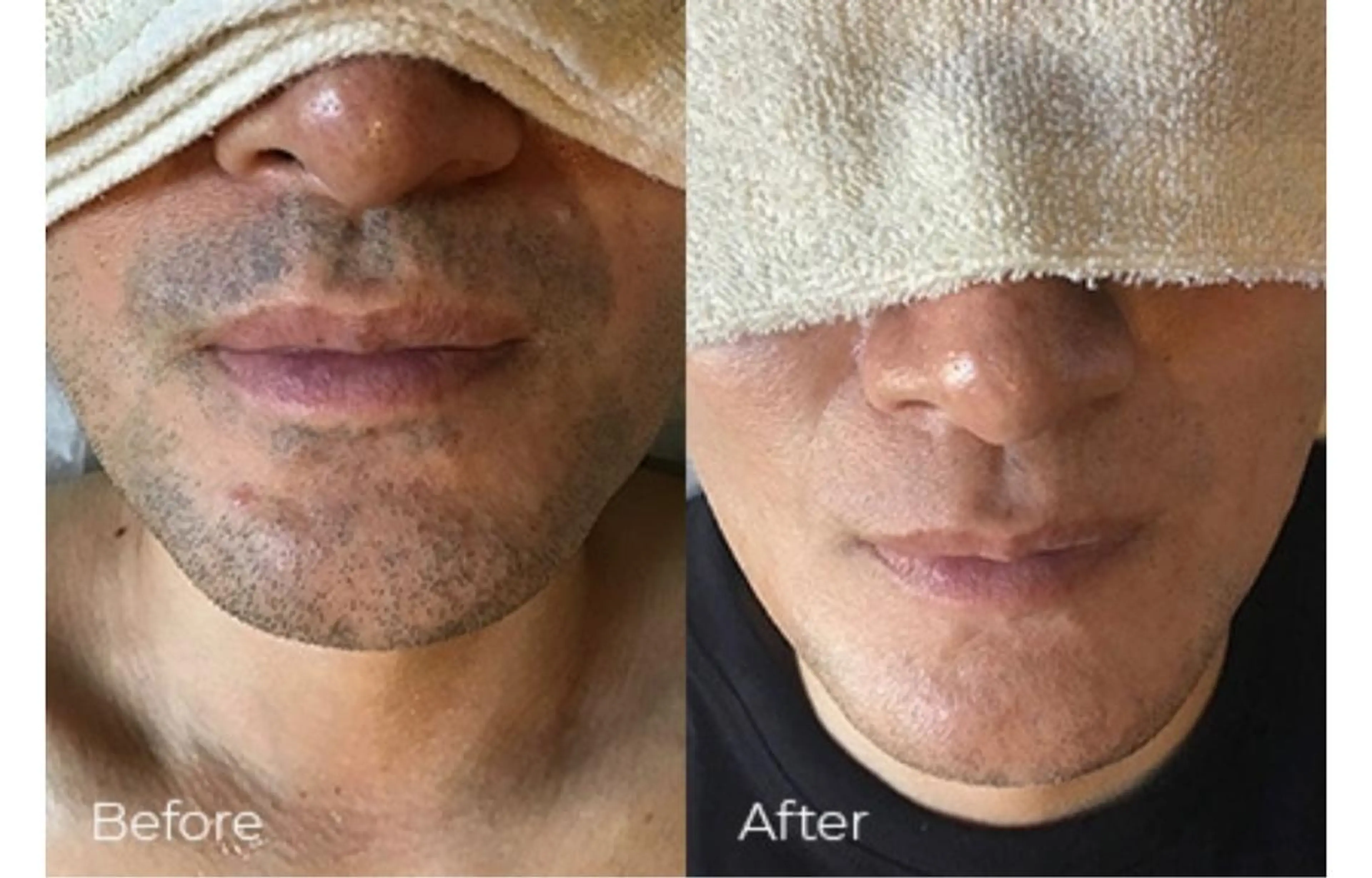 メンズ meravi所属・MERAVI 🫧🌿のマツエク・マツパデザイン