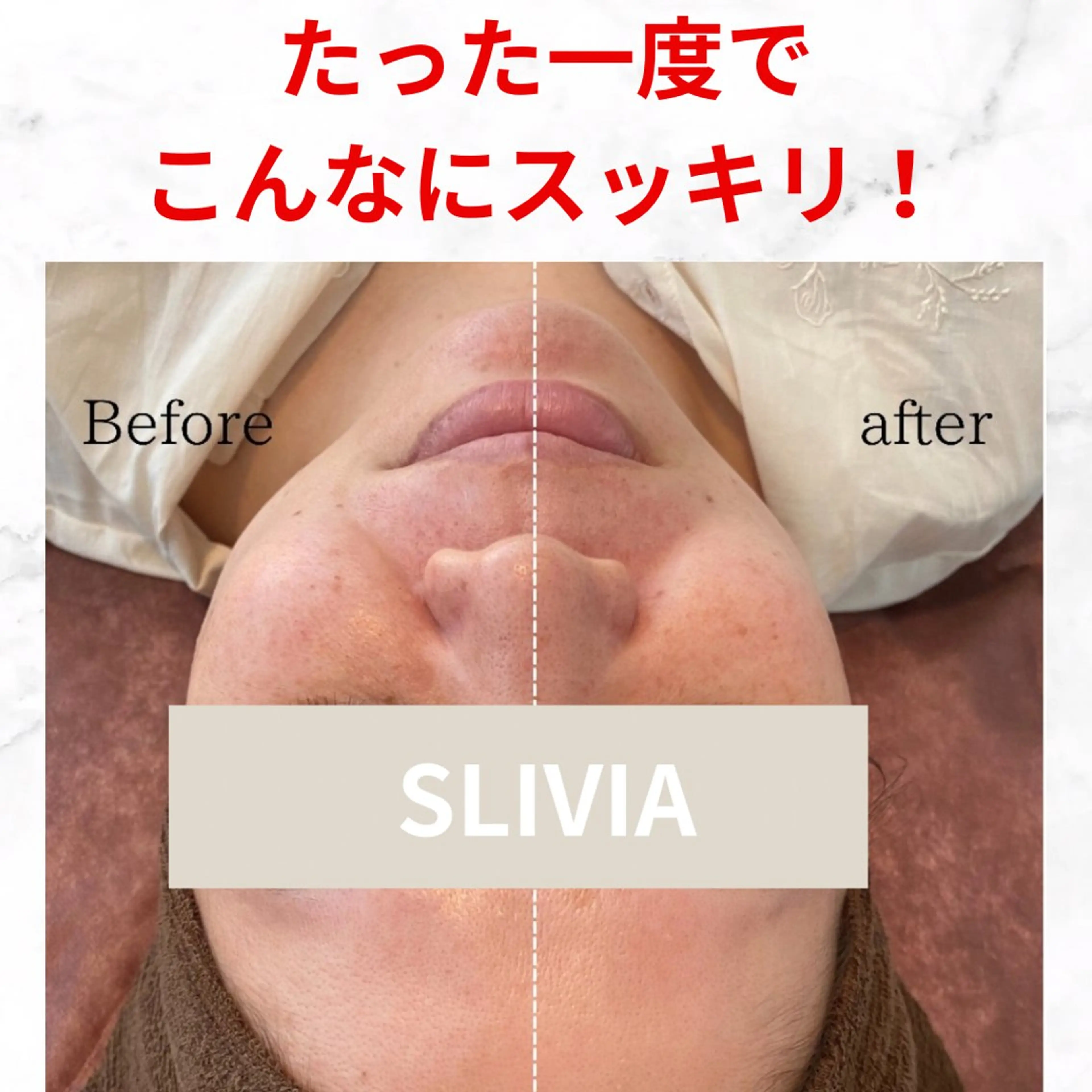 ハイフ&ドライヘッドスパ SLIVIA所属・SLIVIA 毛穴洗浄&ヘッドスパのエステ・リラクイメージ