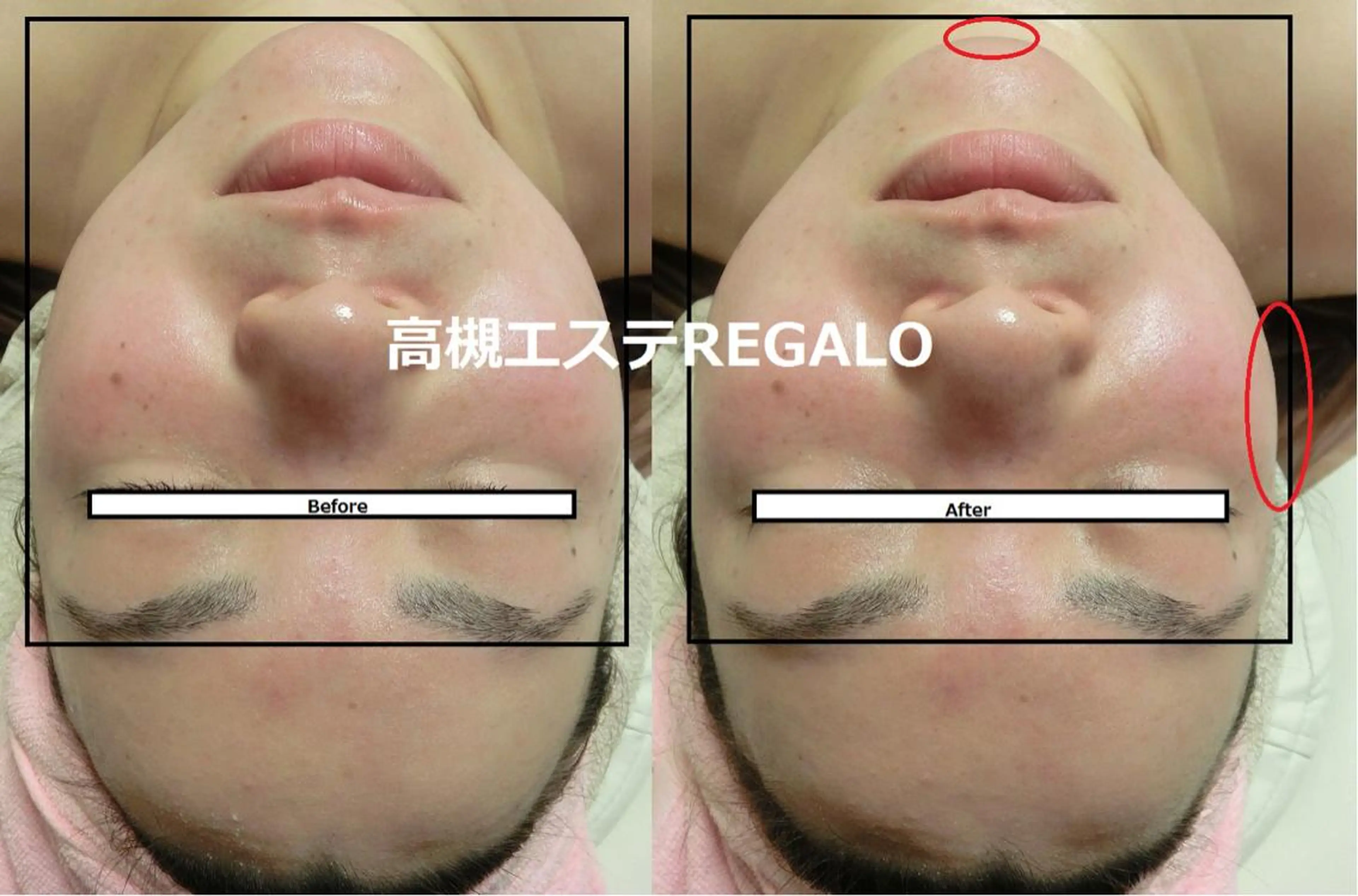 エステ REGALO所属・矢野 さやかのエステ・リラクイメージ