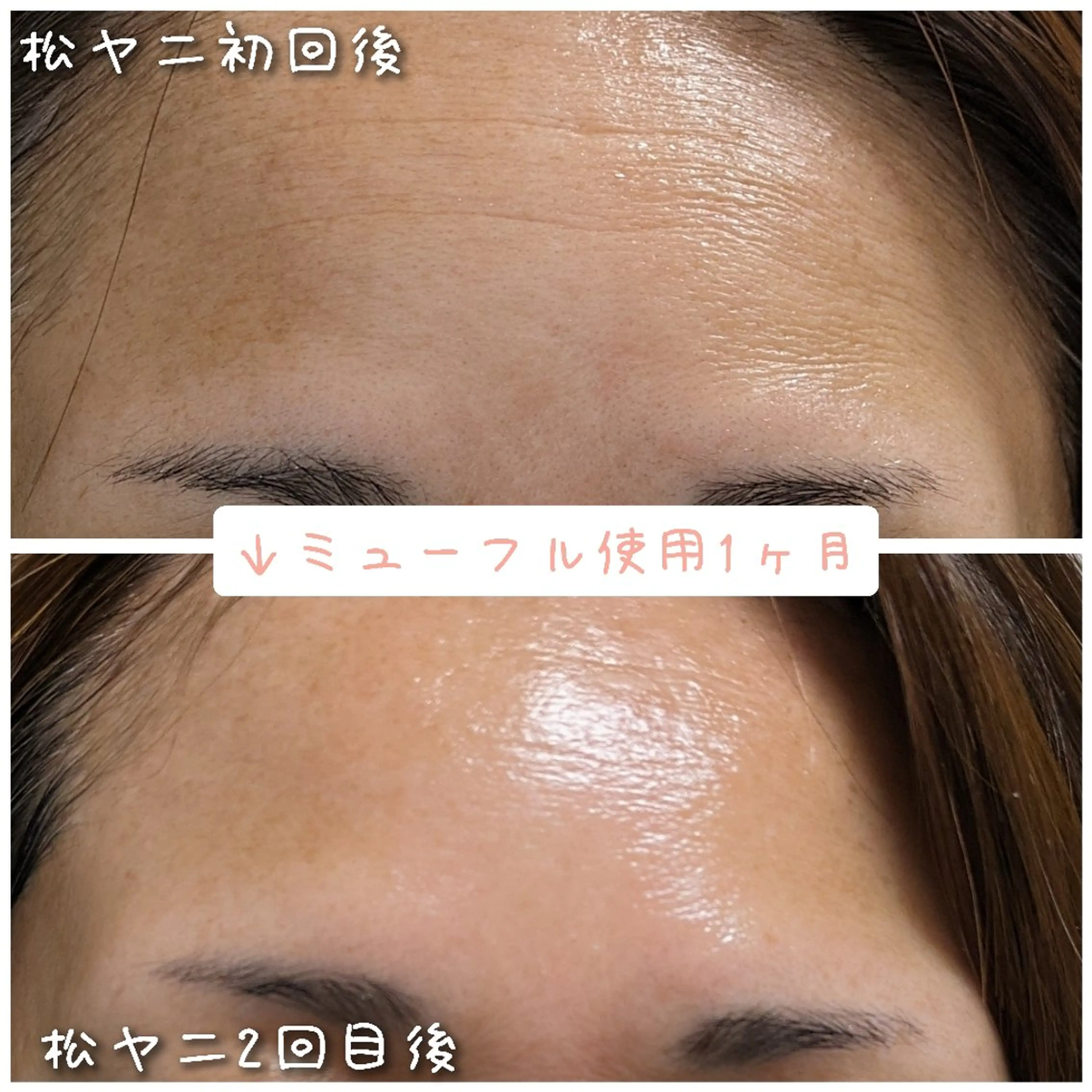 結果が出るスキンケア 肌質改善/まつパのエステ・リラクイメージ