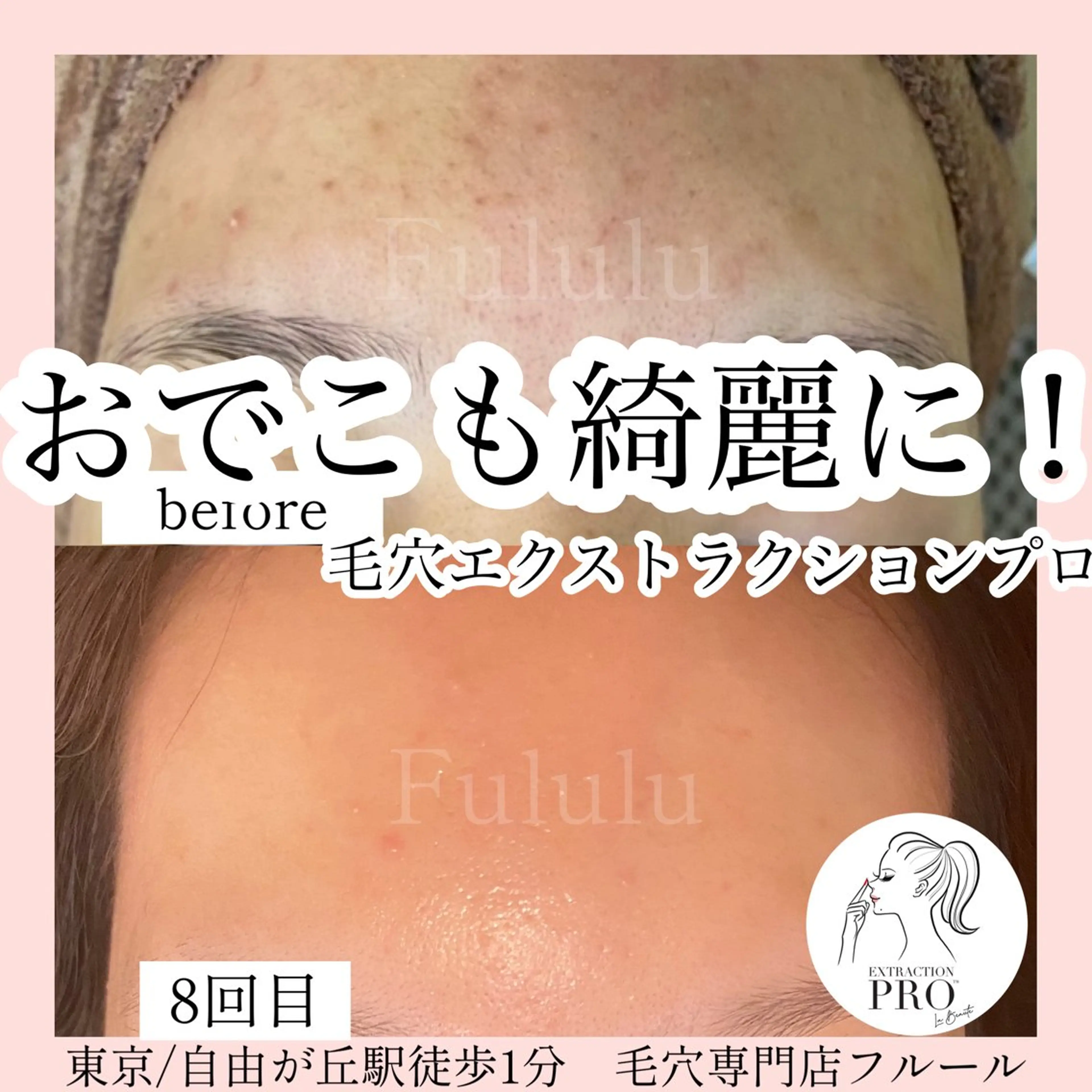 毛穴専門サロン　フルール所属・フルールFululu 自由が丘のエステ・リラクイメージ