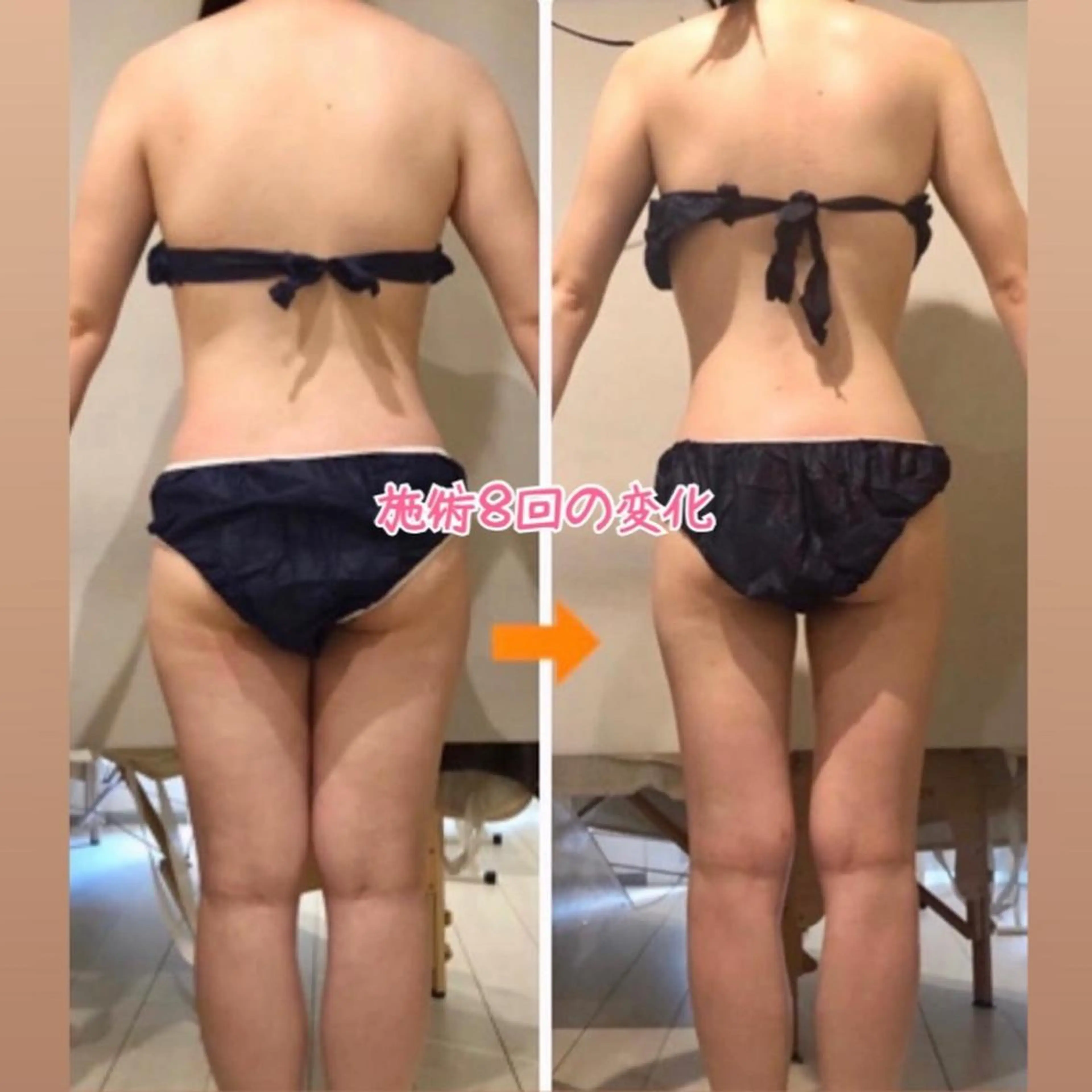 ショート カラー パーマ ヘアアレンジ メンズ キッズ ネイル マツエク・マツパ アイブロウ エステ リラク ‍痩身＆ボディ 結果出し🌟丹野のエステ・リラクイメージ