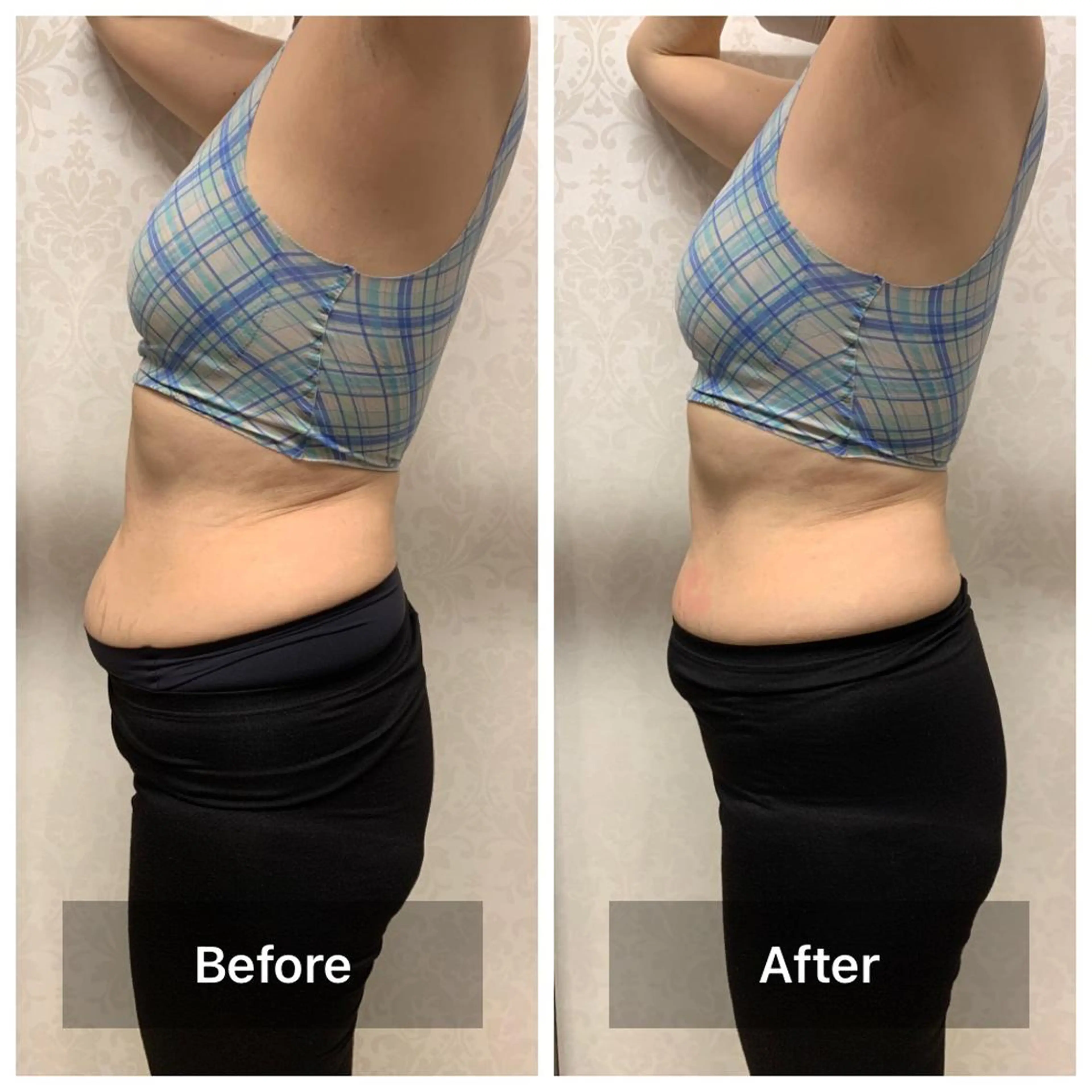 脱毛＆エステサロン【アンリミット】所属・森谷 莉美のエステ・リラクイメージ