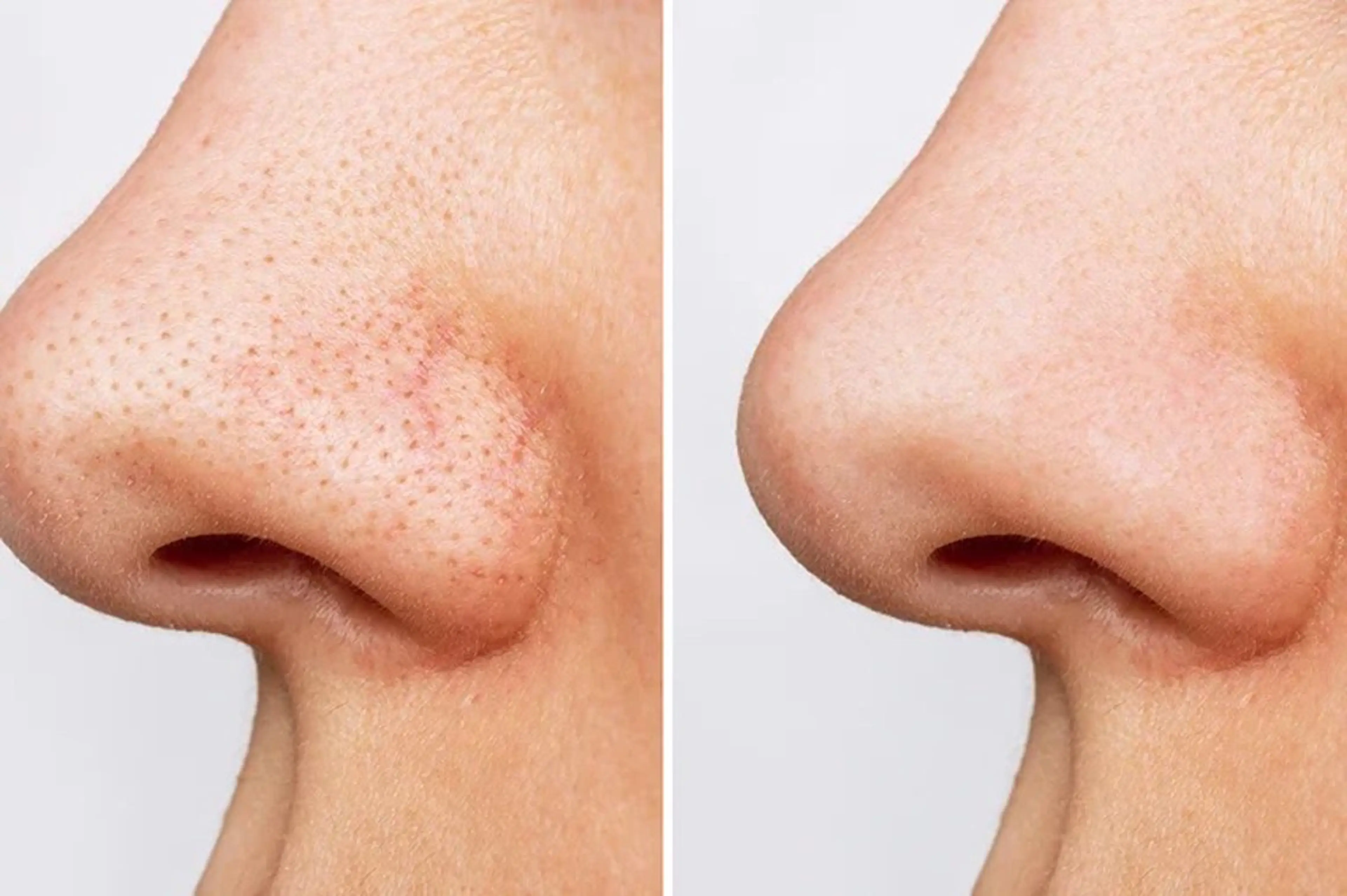 アイアンド ネイルデイのエステ・リラクイメージ