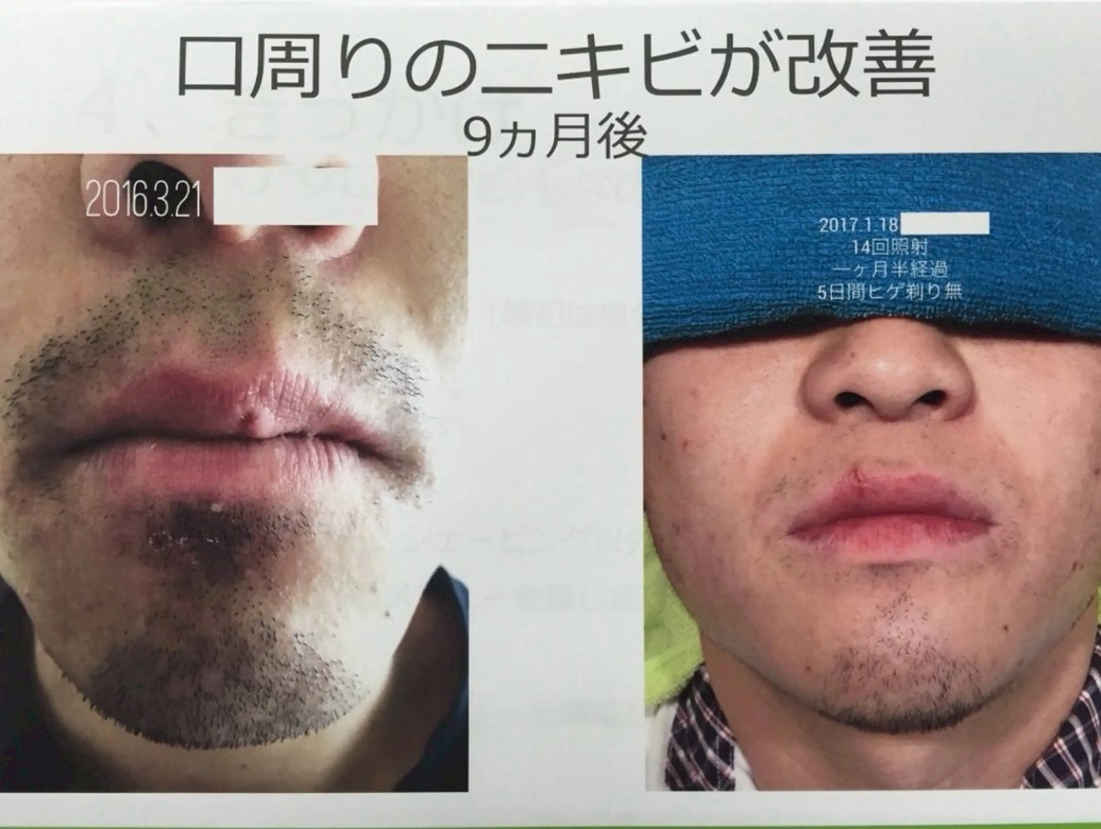 Feather TOMのエステ・リラクイメージ