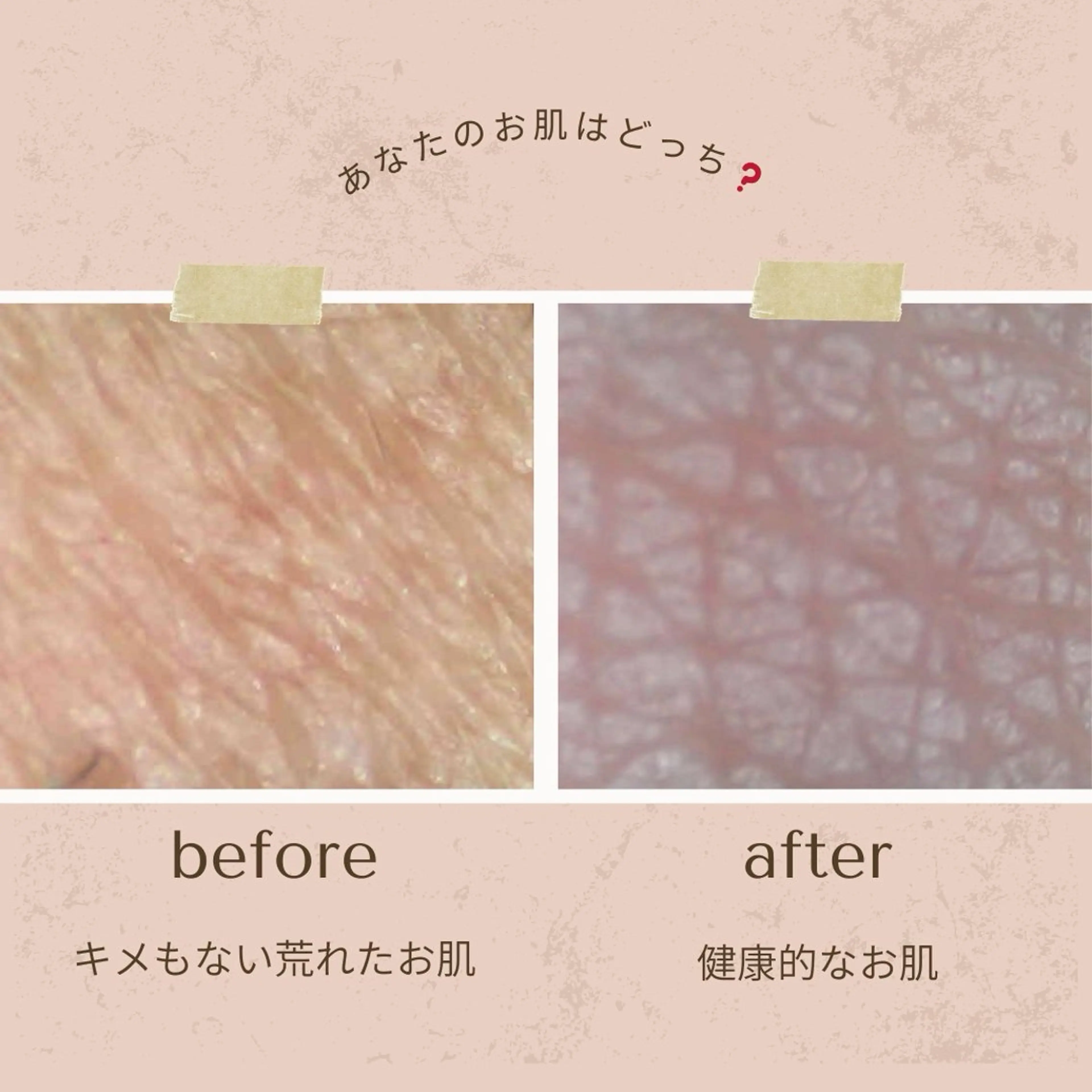 メンズ メンズ韓国風 エステ 韓国最先端技術サロン Luangeのエステ・リラクイメージ