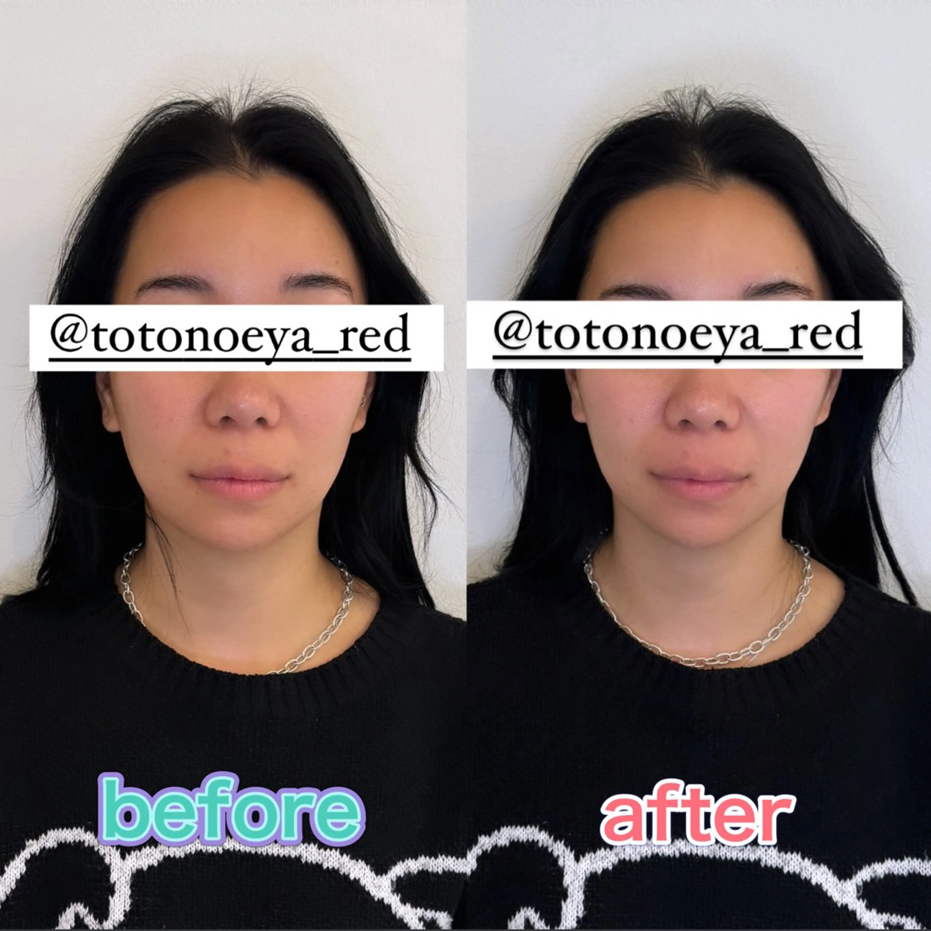 小顔矯正&美容整体 整え屋REDオーナーのエステ・リラクイメージ