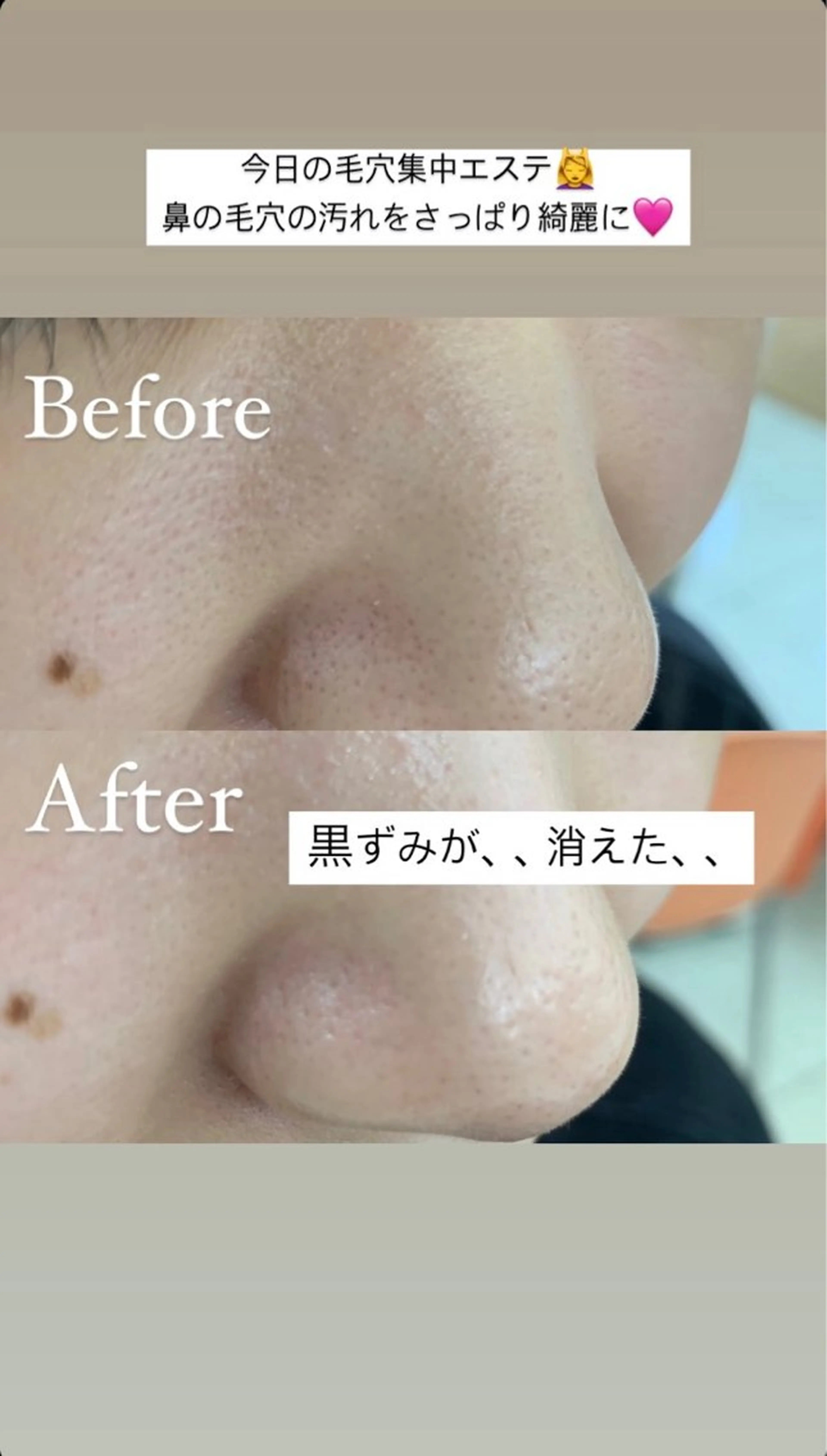 デ・アイム新潟　　北所属・山口 萌のエステ・リラクイメージ