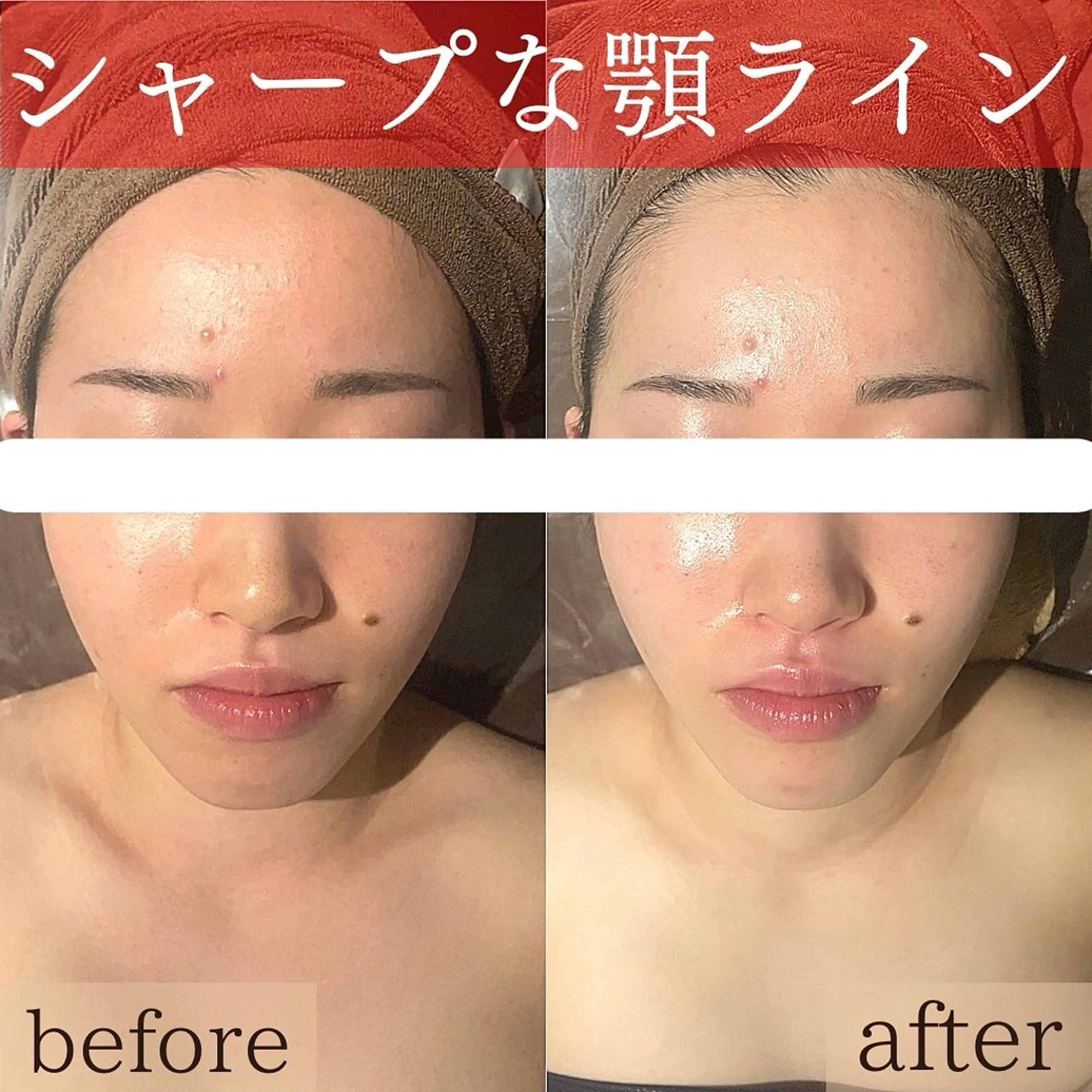 エステ リラク こりとりコルギ専門店MIICO所属・こりとりコルギ専門店 勝　友里奈のエステ・リラクイメージ