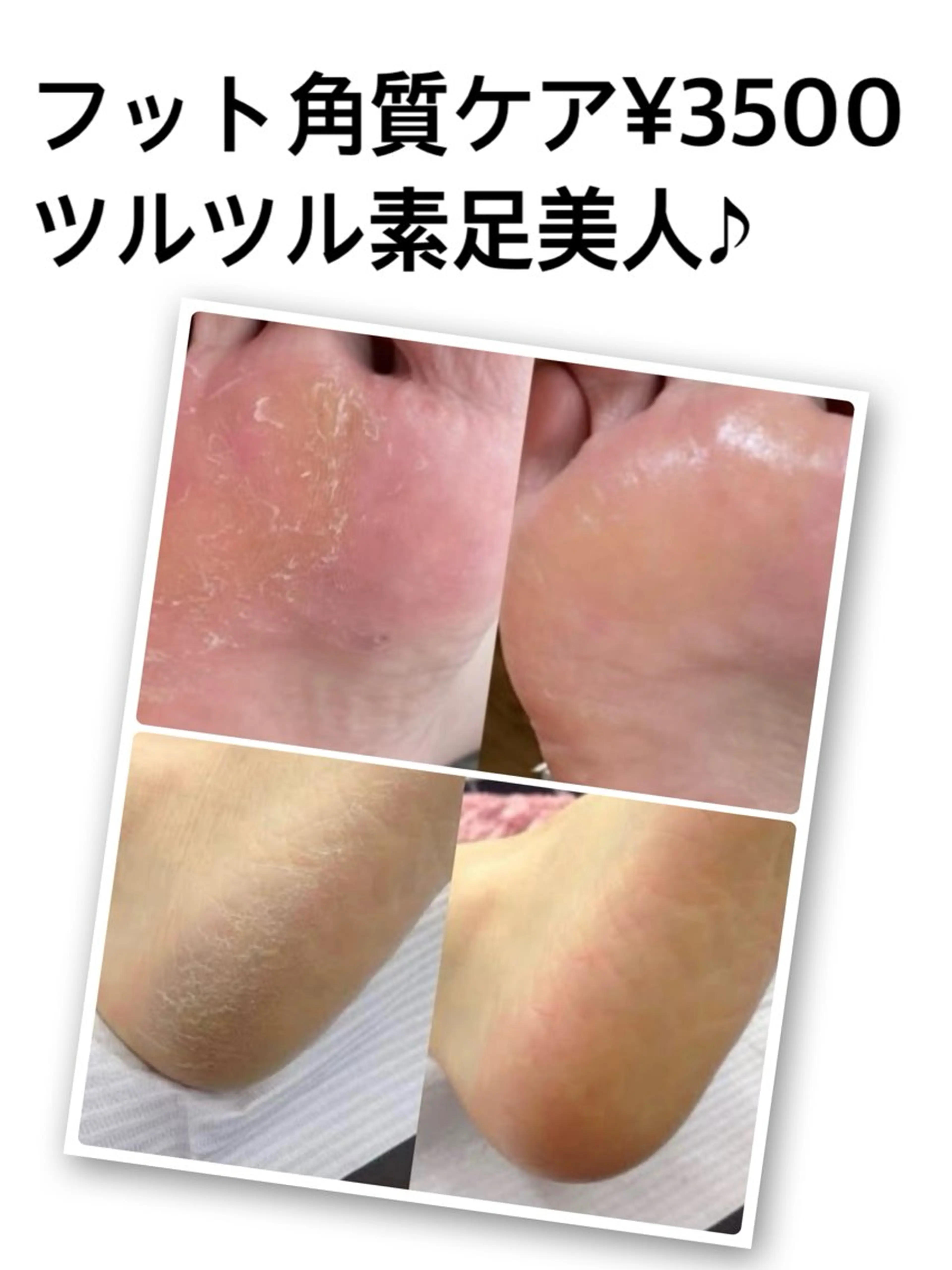 ネイル 戸田 宏美のネイルデザイン