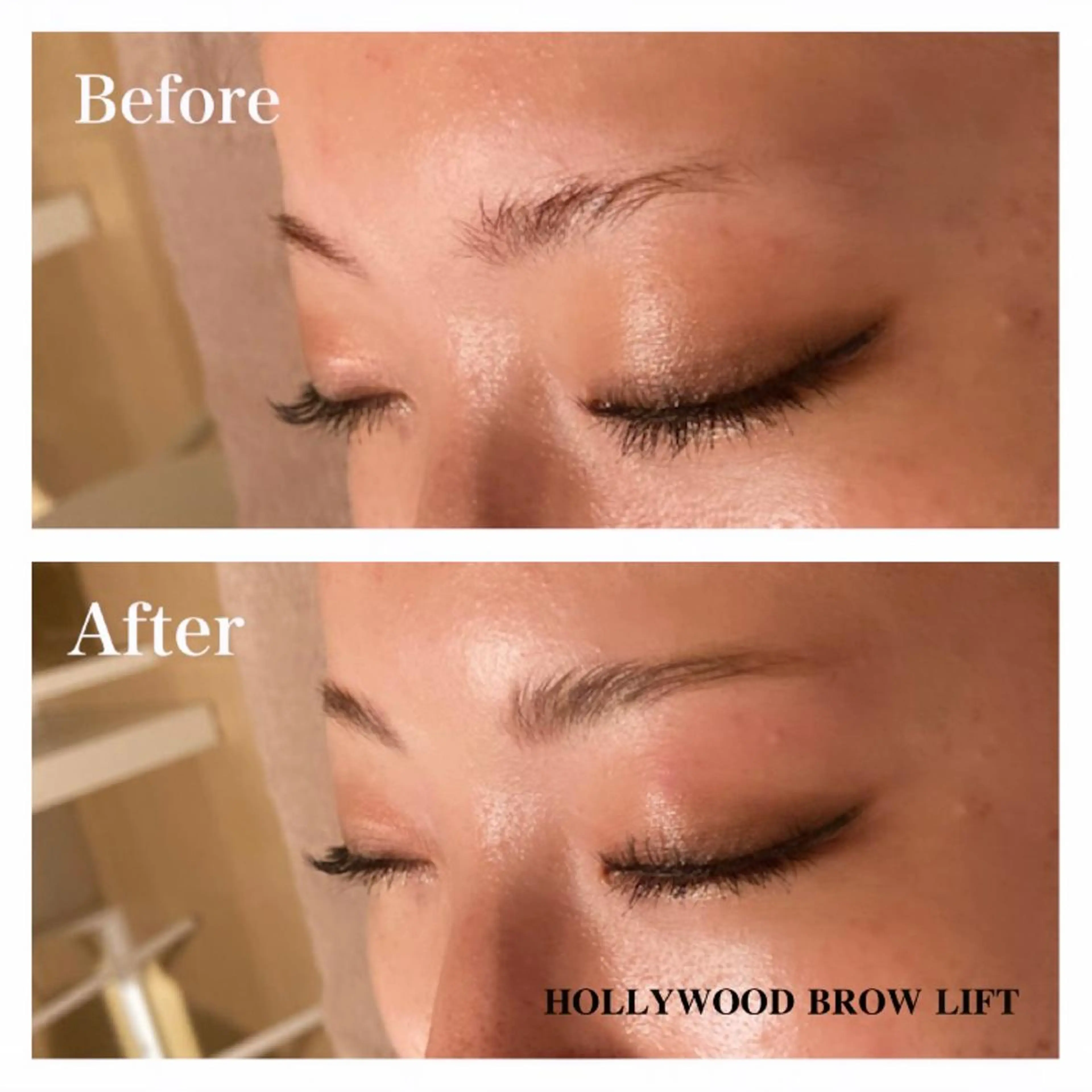 アイブロウ Ｂ&H所属・頭痛•肩こり専門/ 眉サロンB&H心斎橋のエステ・リラクイメージ