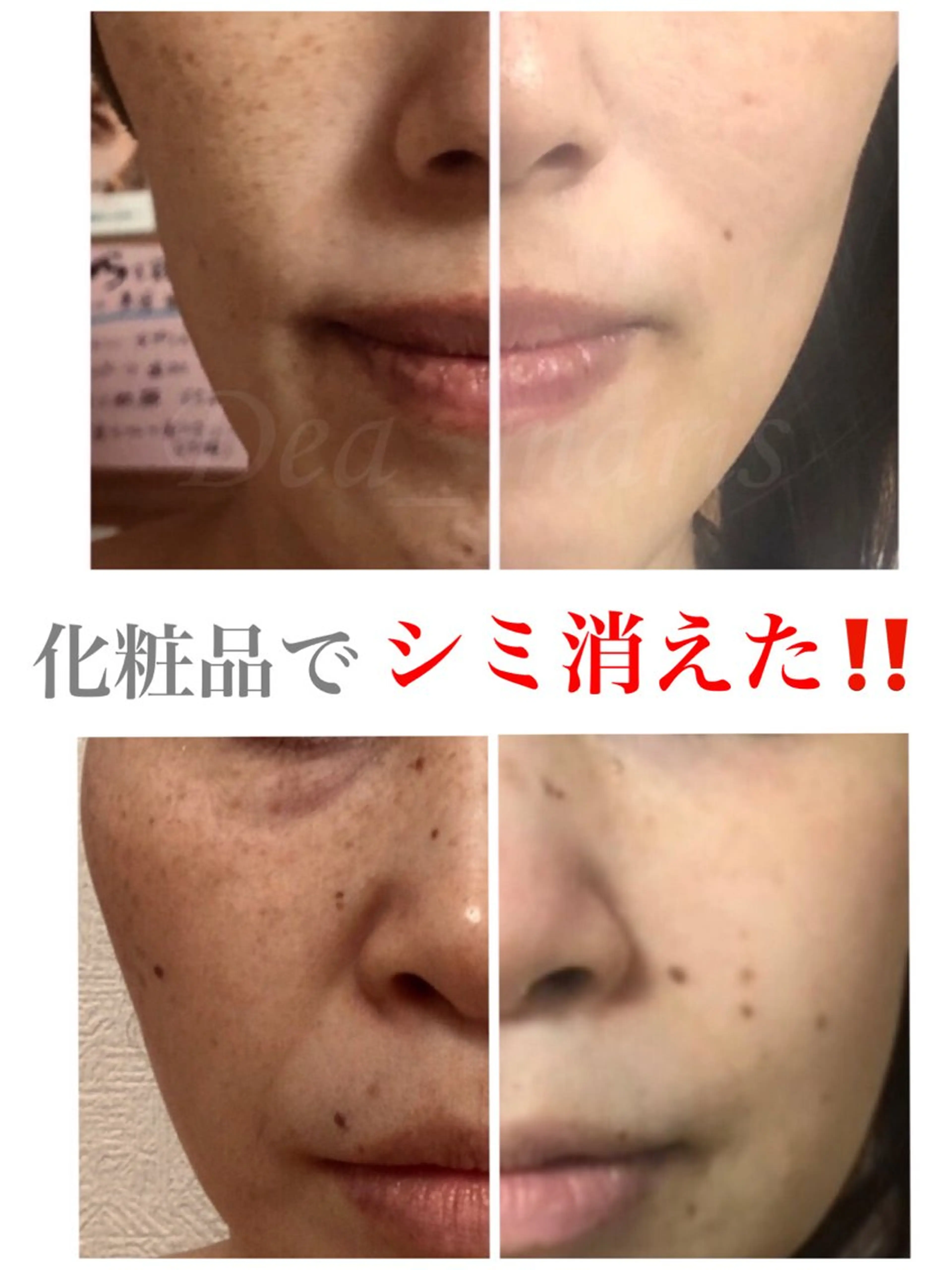 【初回・コンテスト受賞記念 先着3名限定】オーダーメイドフェイシャル初回体験15000円→8000円の写真