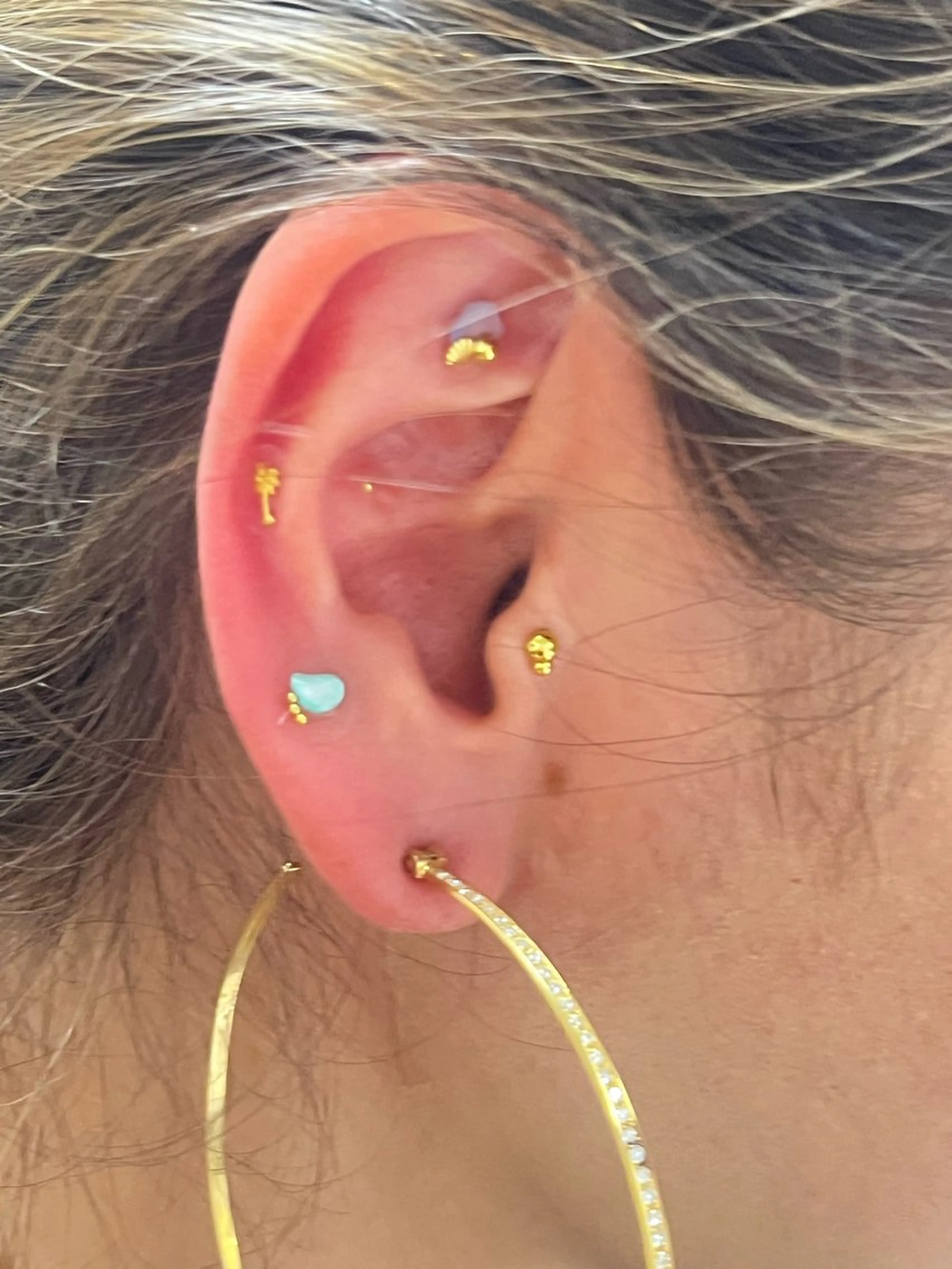 耳つぼジュエリー💍(10粒)の写真