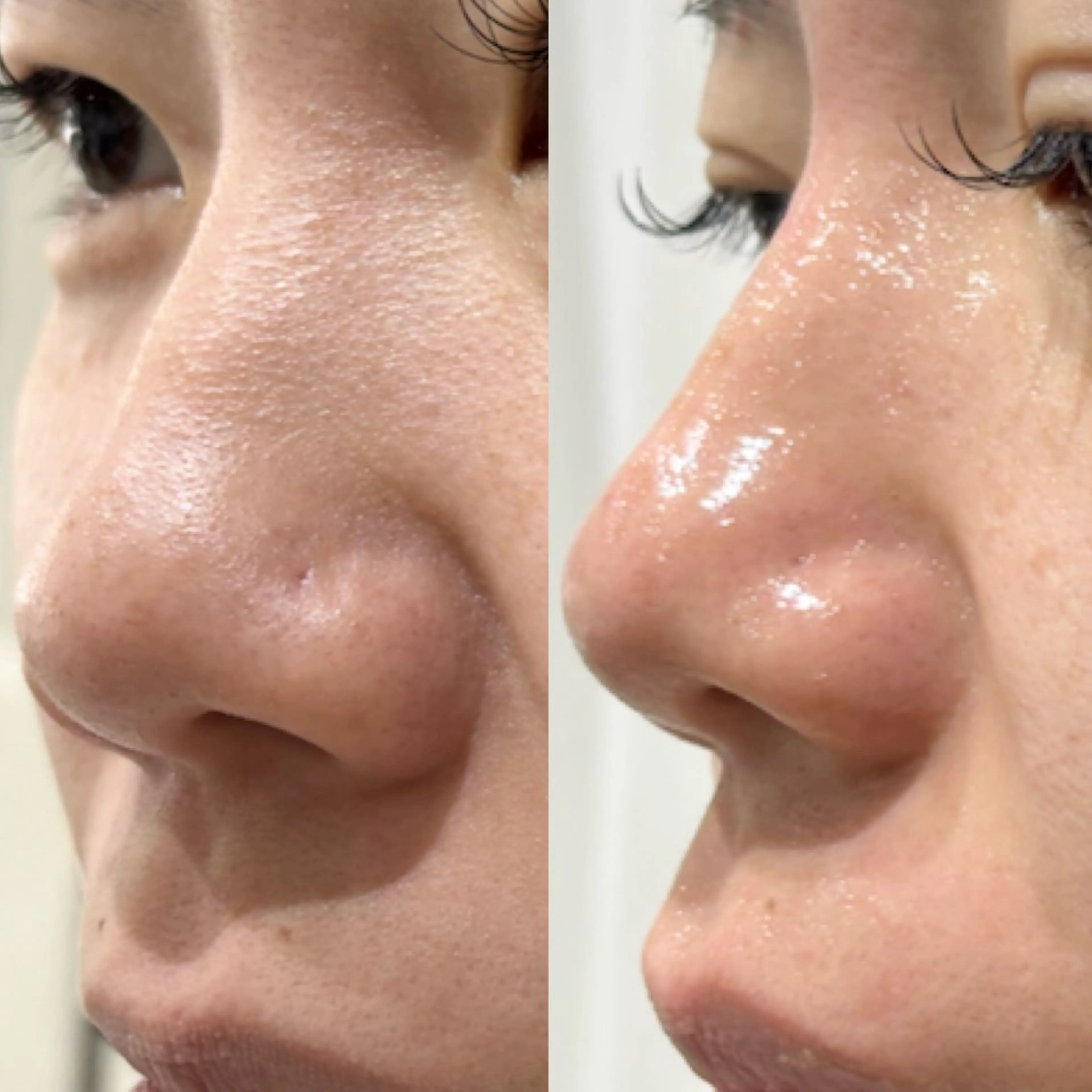 毛穴に特化したサロン MYFAIRLADYのエステ・リラクイメージ