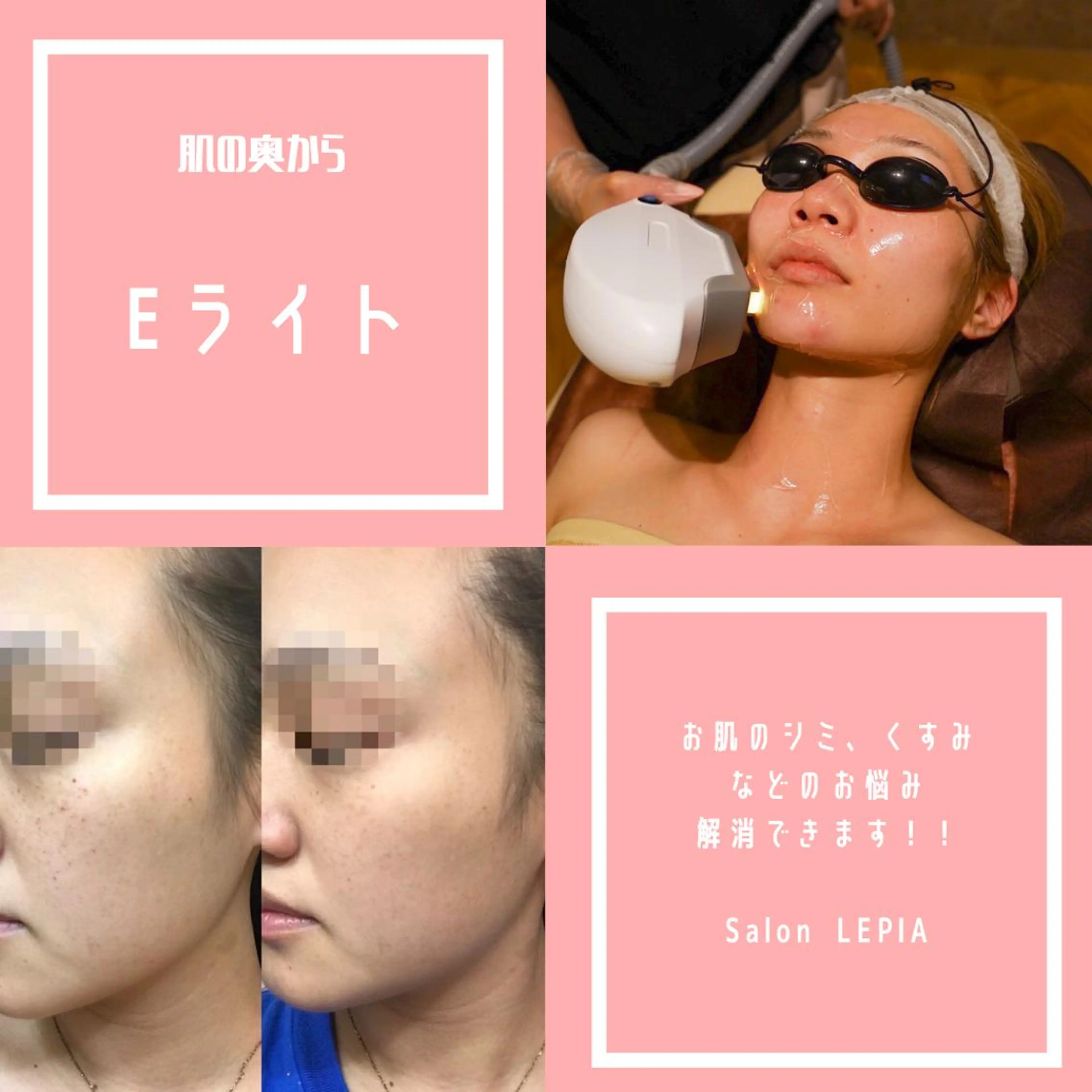 男女同額完全個室脱毛 LEPIA内田のエステ・リラクイメージ