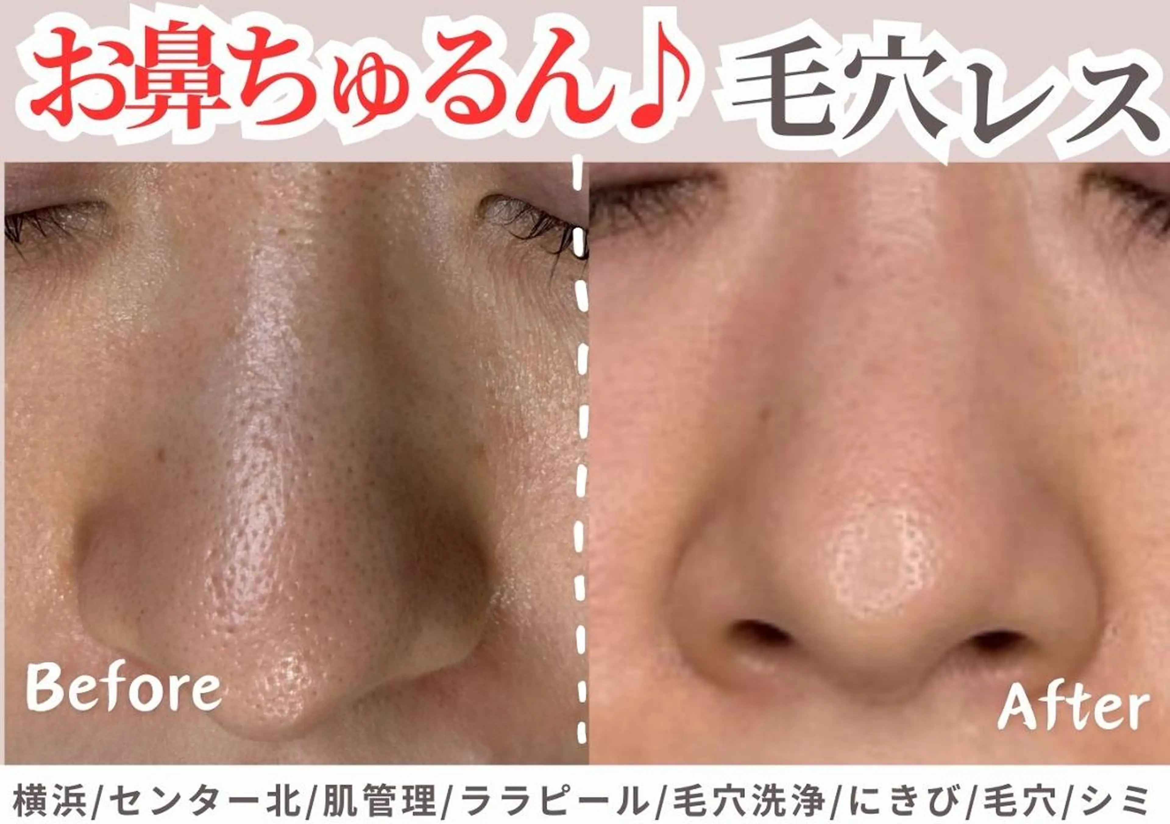 エステ sii センター北 AIのエステ・リラクイメージ