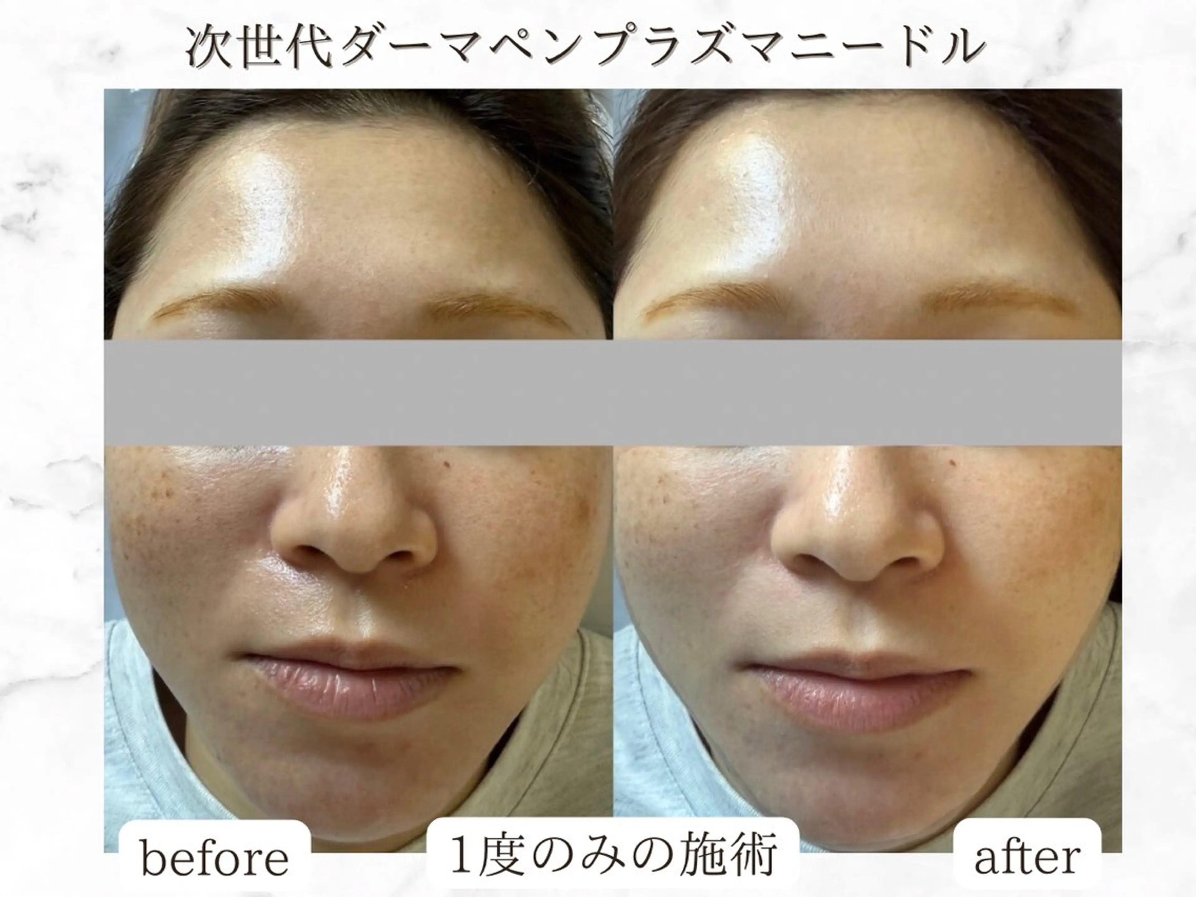 Rairy所属・Rairy Salon富士見町のエステ・リラクイメージ