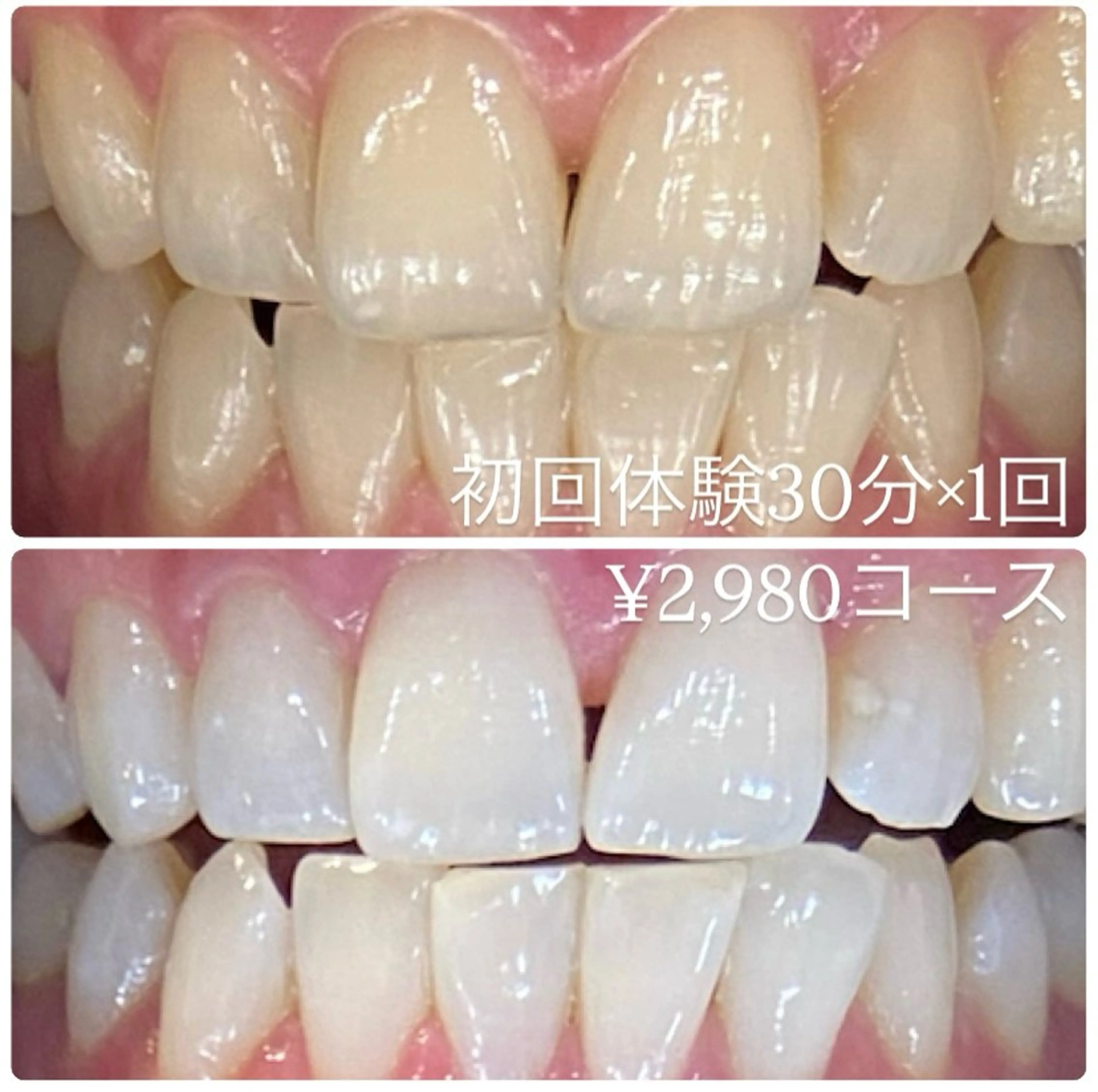 PLATINUM Beauty 横浜店所属・ホワイトニングルーム 横浜店のその他イメージ