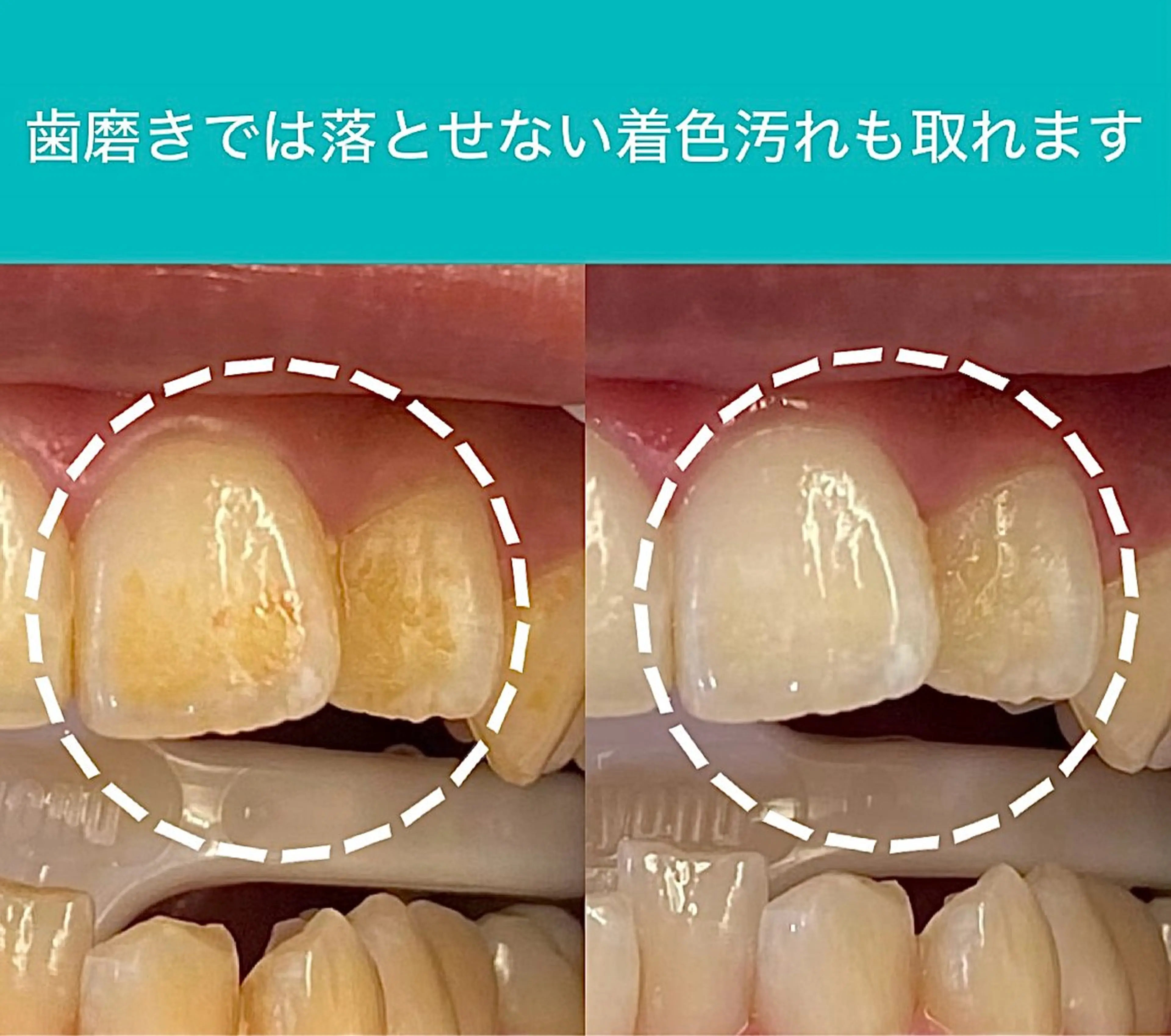 Retreatリトリート所属・歯科医院提携 Retreatのエステ・リラクイメージ