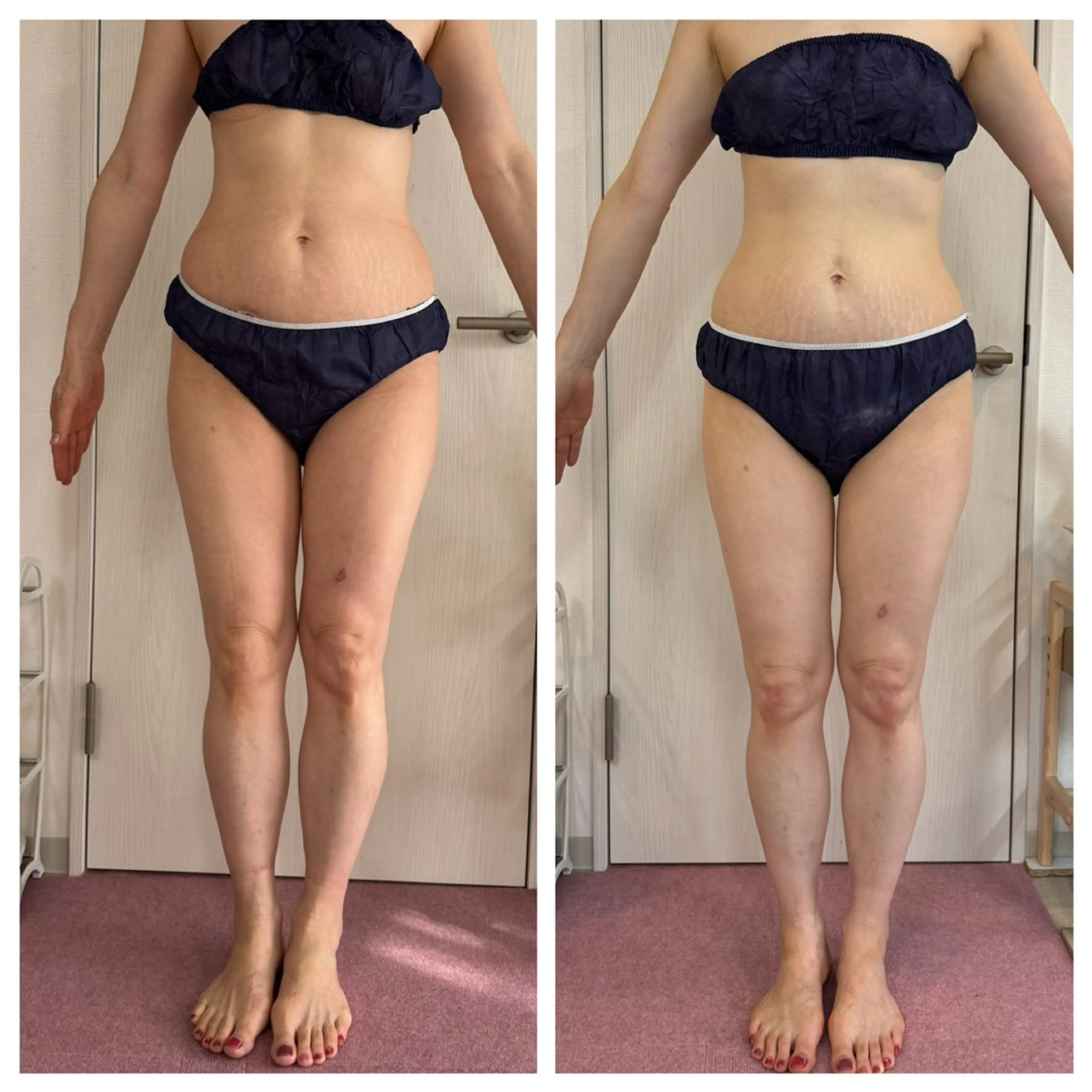 エステ 武藤 千裕のエステ・リラクイメージ