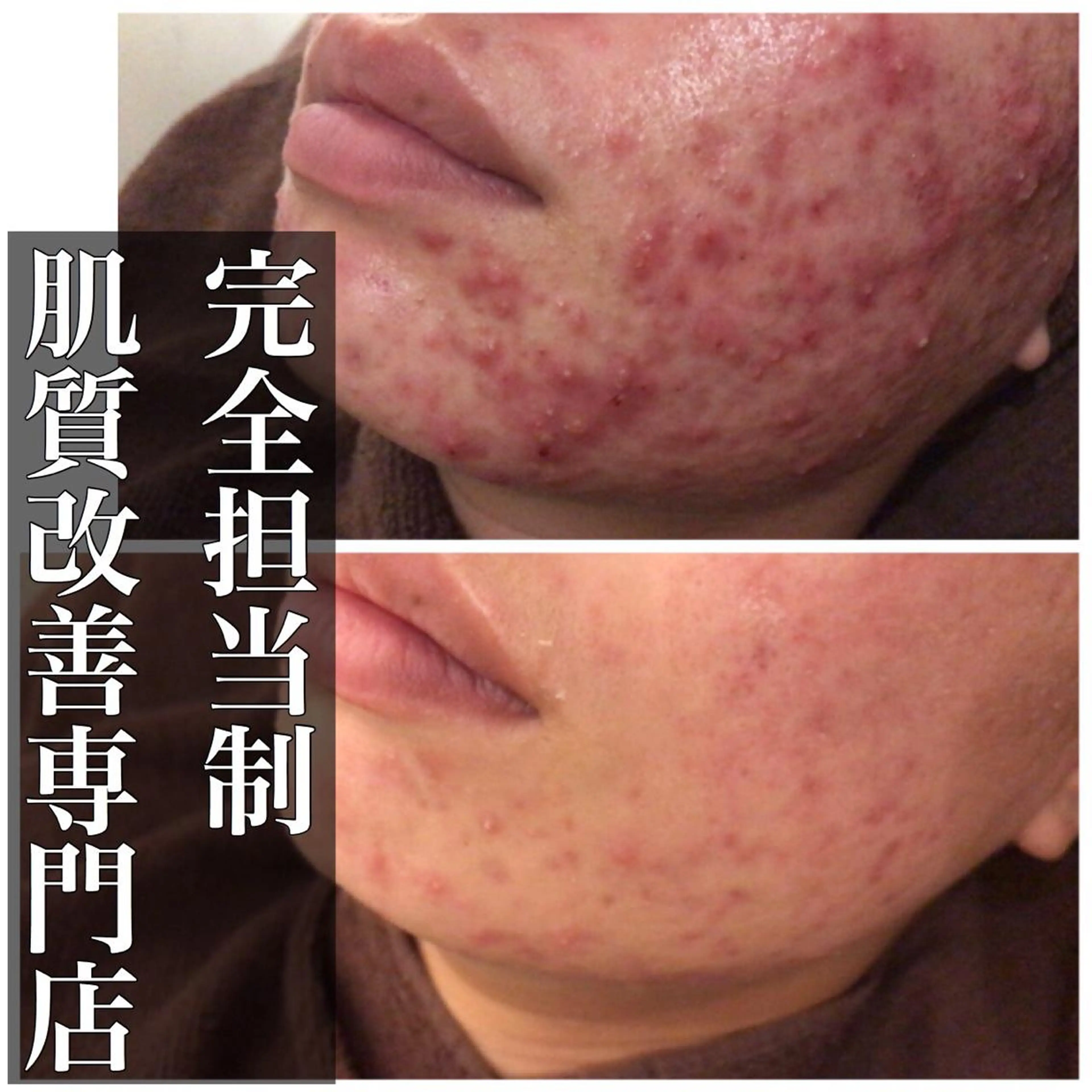 ミディアム カラー パーマ ヘアアレンジ メンズ キッズ ネイル マツエク・マツパ エステ リラク ニキビ・肌質改善専門 ♡人生が変わるサロンのエステ・リラクイメージ