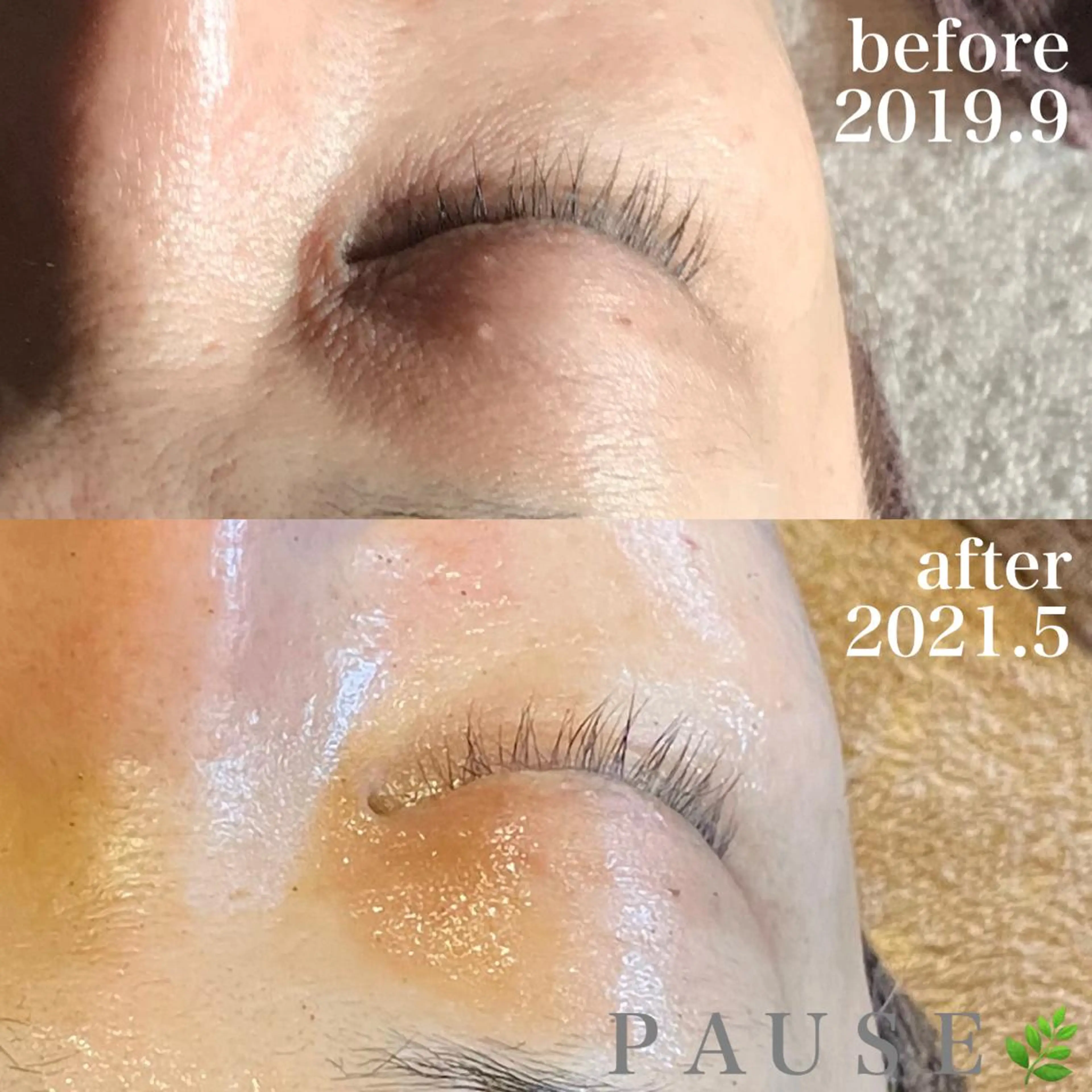 エステ 浜野 恵美のエステ・リラクイメージ