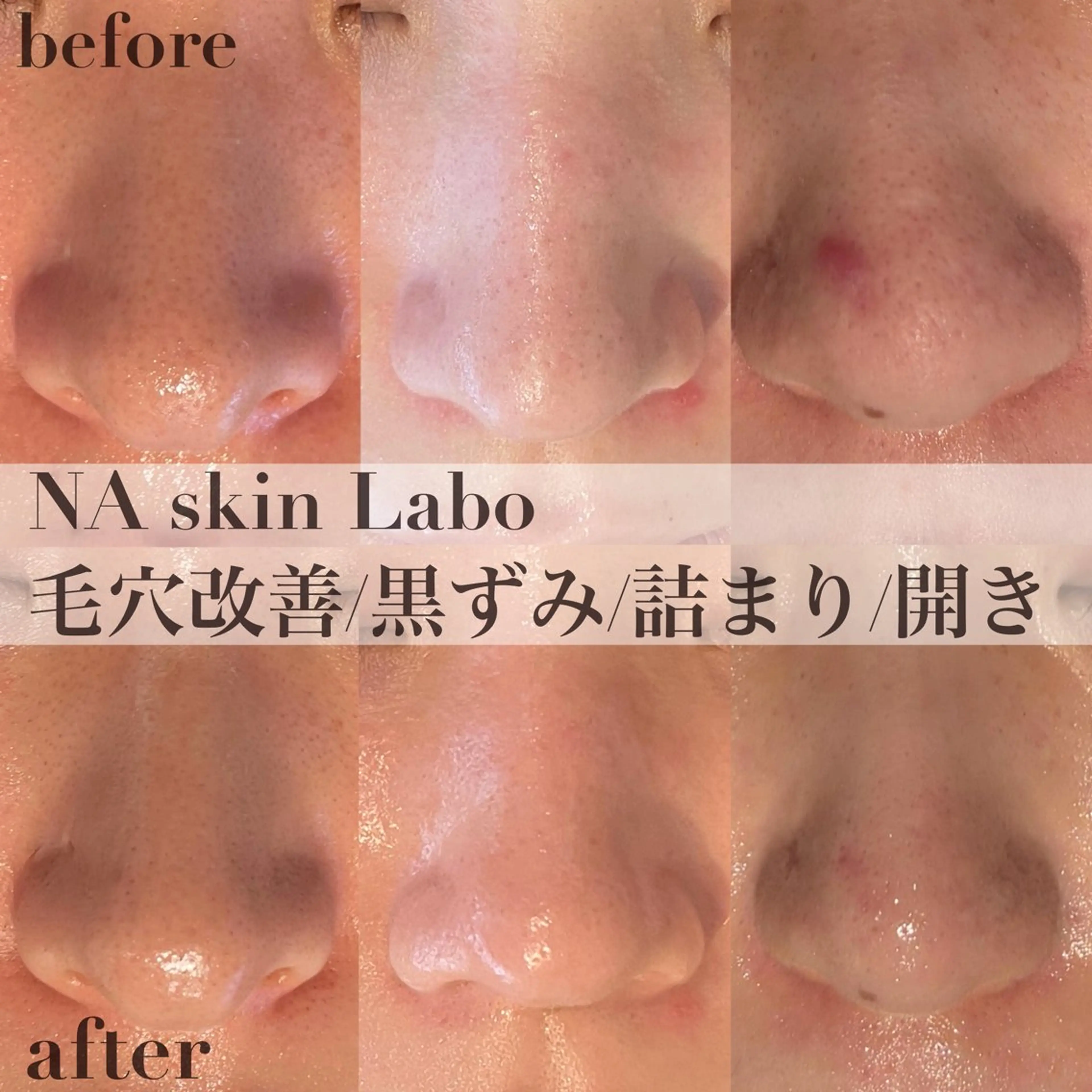 NA skin たまプラーザ　川島のエステ・リラクイメージ