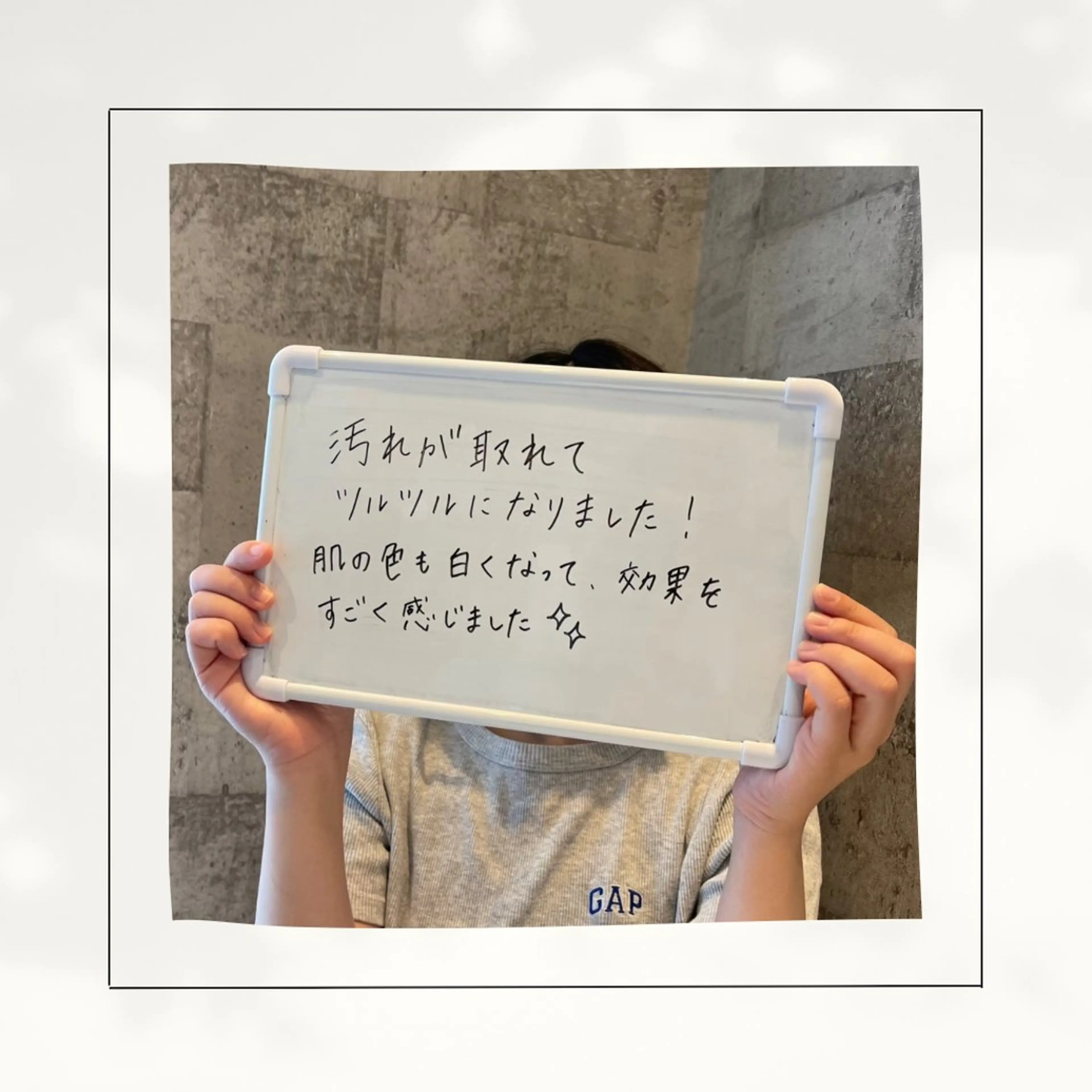 エステ シミ・毛穴専門店 gracia 宇土店所属・シミ・毛穴専門店 /gracia 安藤のエステ・リラクイメージ