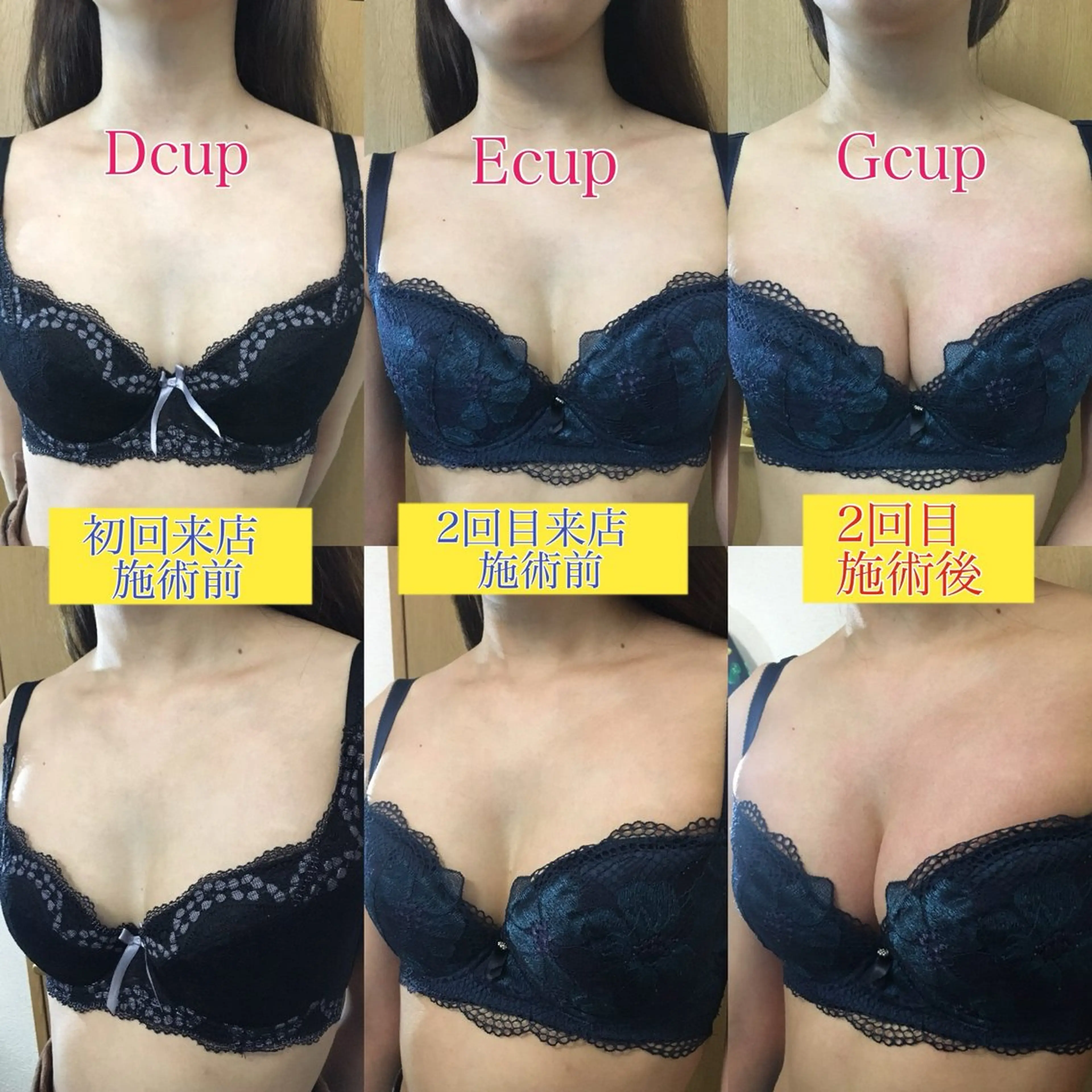 エステ デリケートな悩み解決 Rebloomのエステ・リラクイメージ