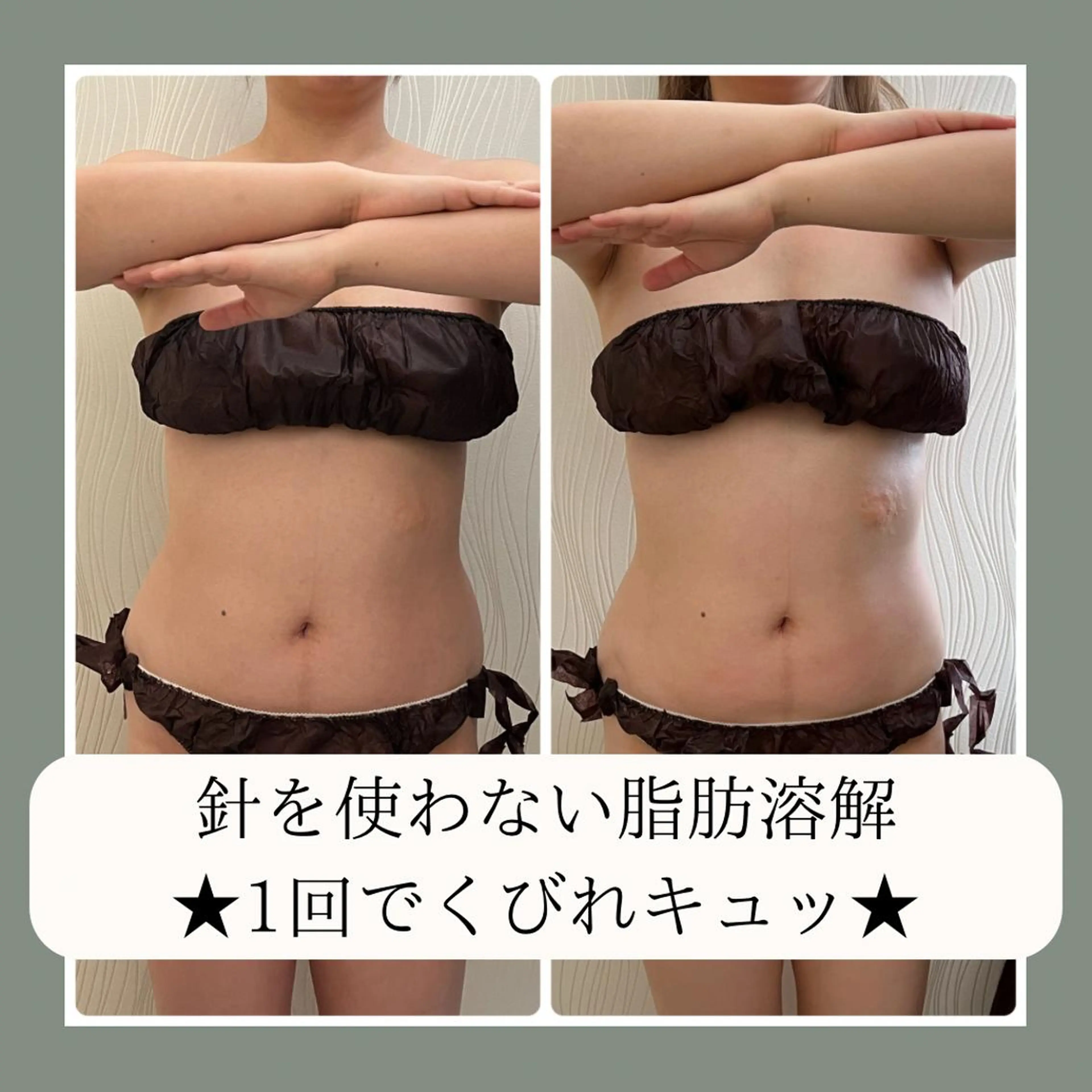 大阪市初！男性もok 酵素浴/痩身/小顔のその他イメージ