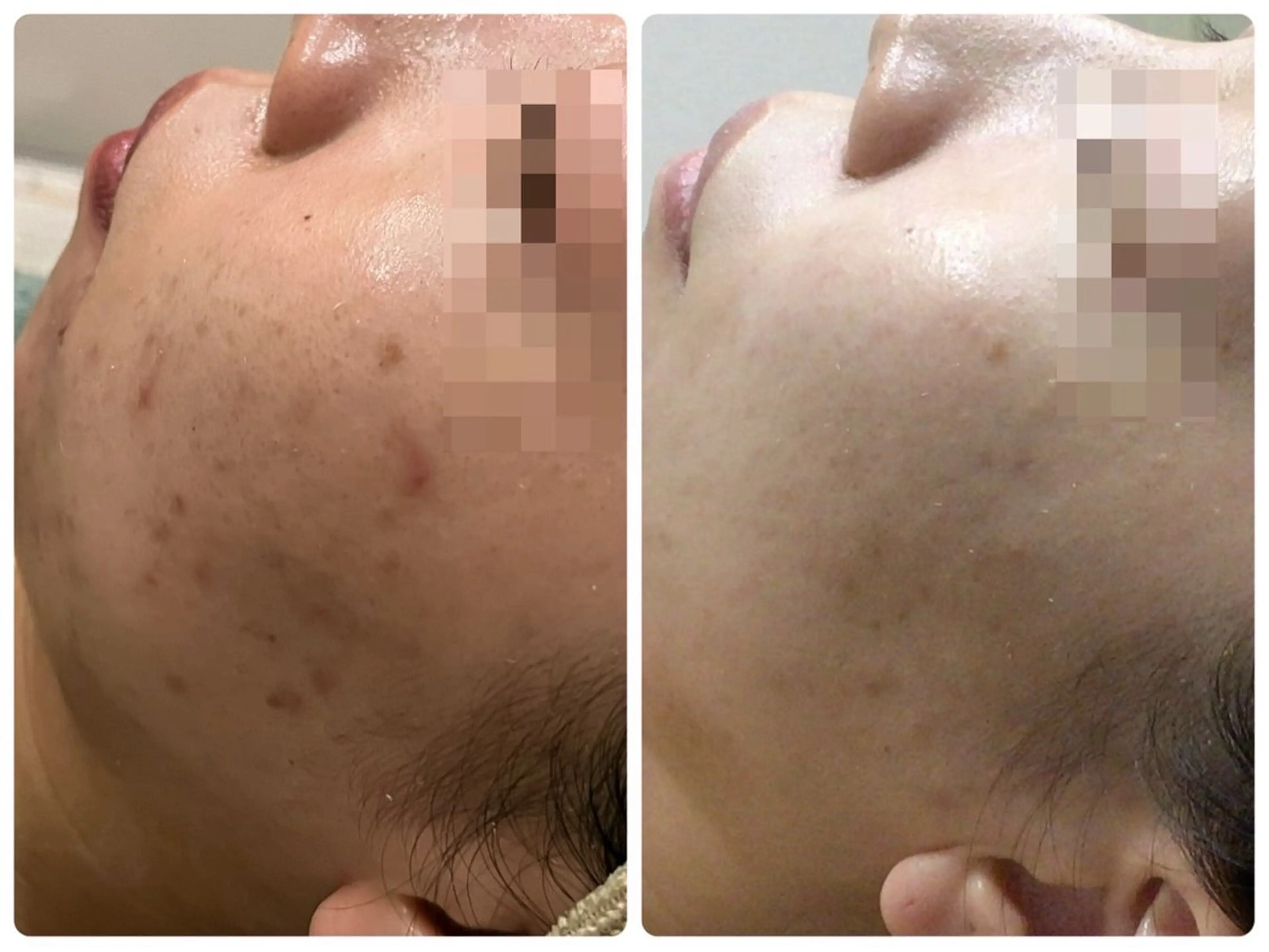 エステ 脱毛&フェイシャル 専門店muro.のエステ・リラクイメージ