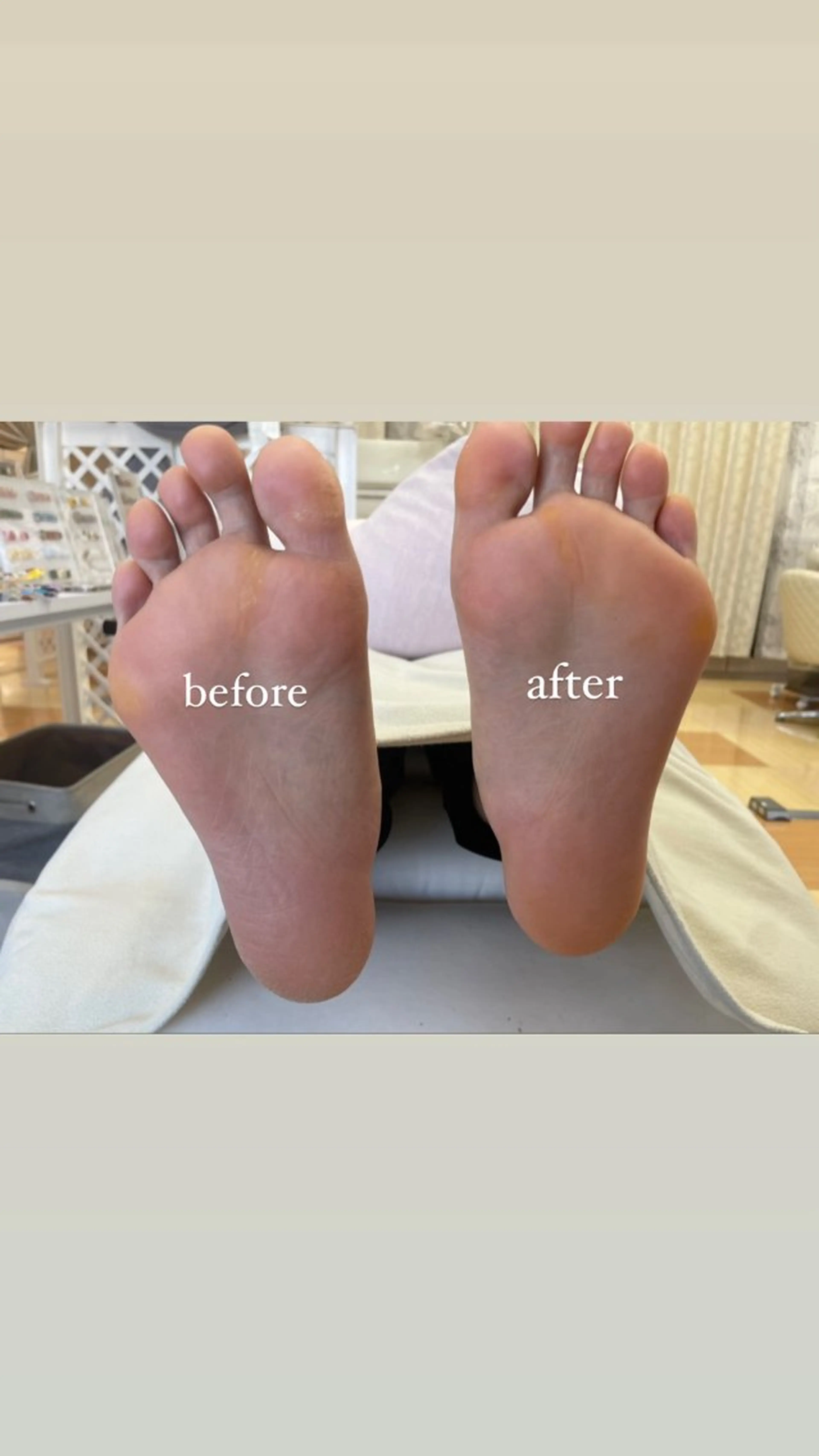 フット角質ケア🦶の写真