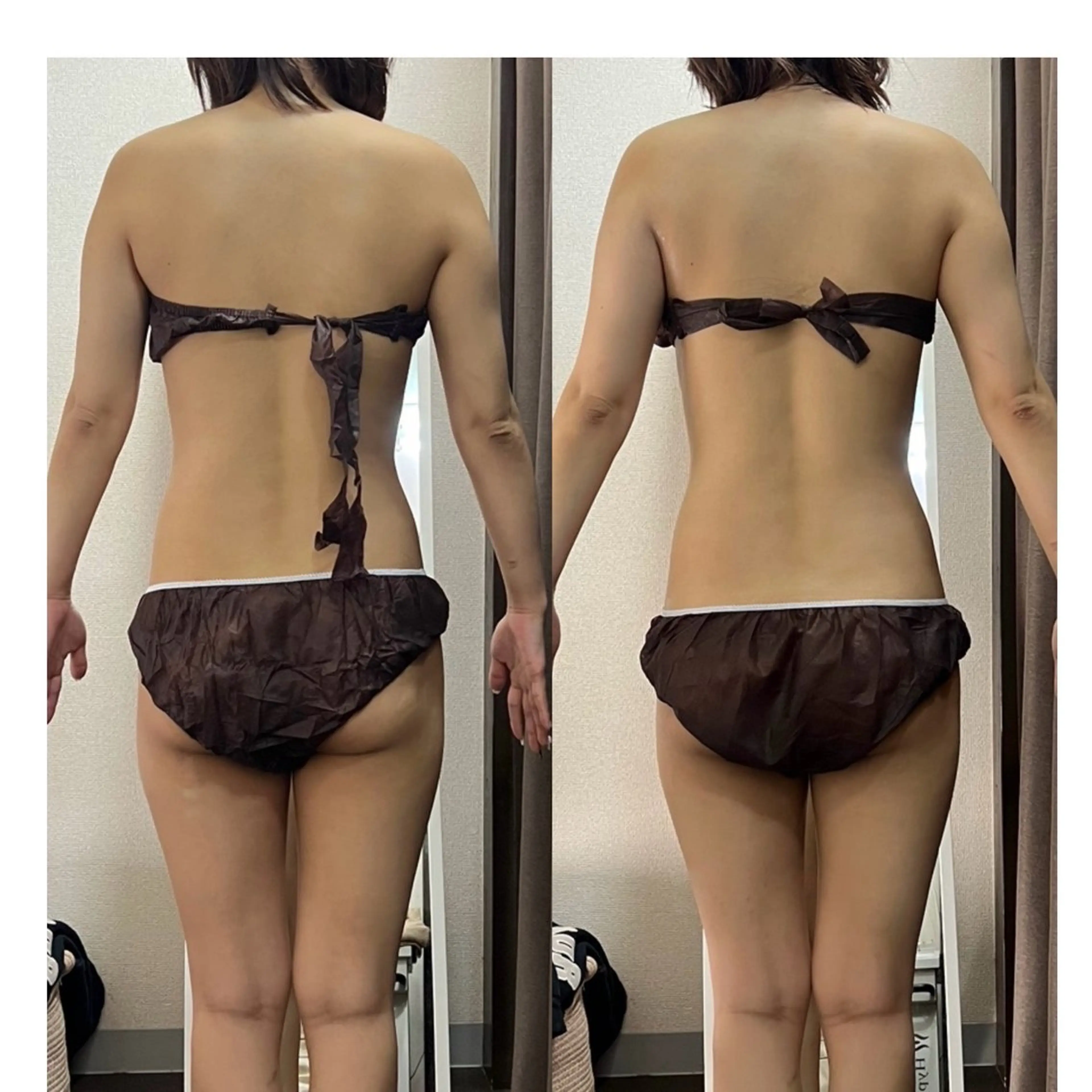 エステ ハイパーナイフ専門店　Salon de COCO所属・Salon de COCOのエステ・リラクイメージ