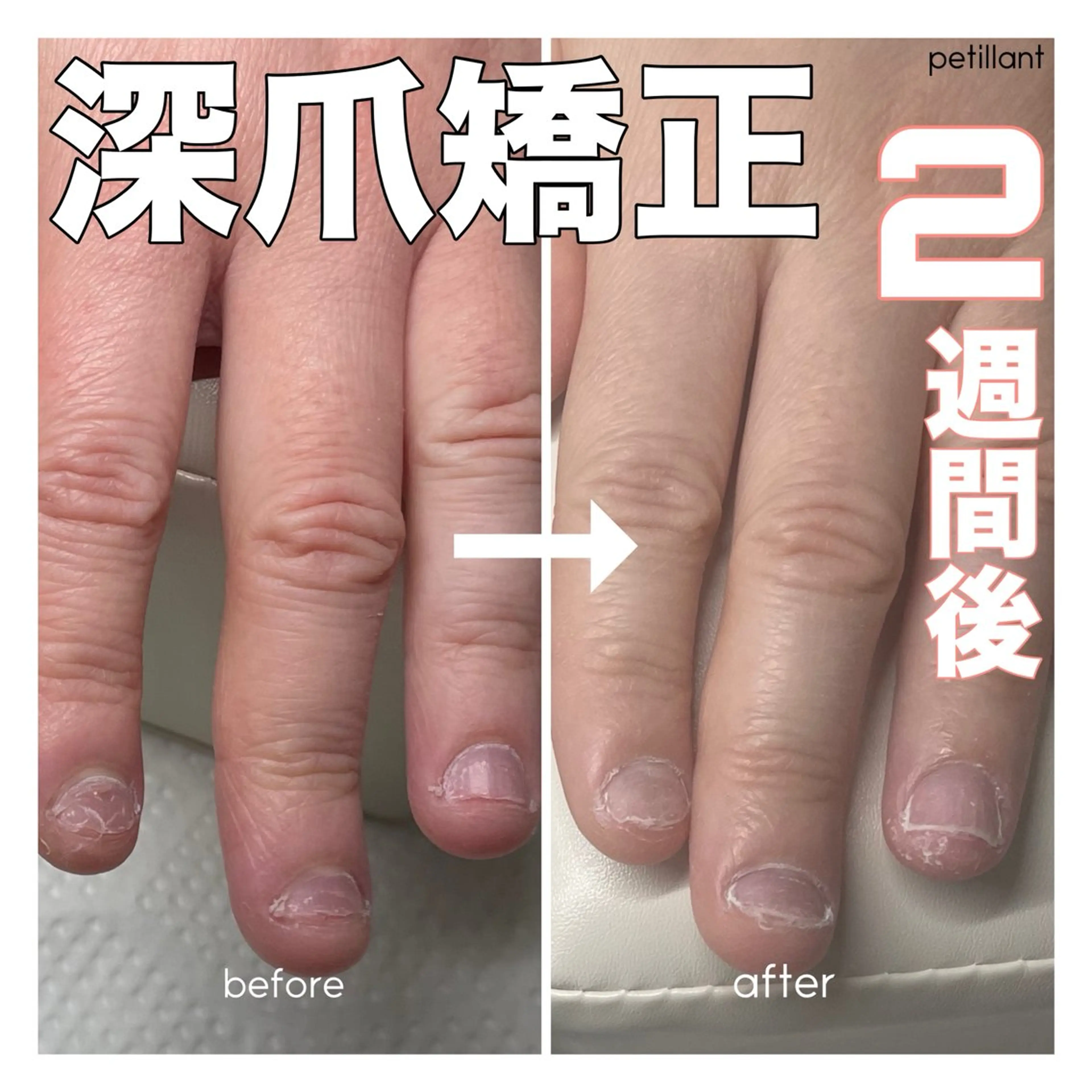 ネイル ジェルネイル petillant所属・nail salon petillantのネイルデザイン