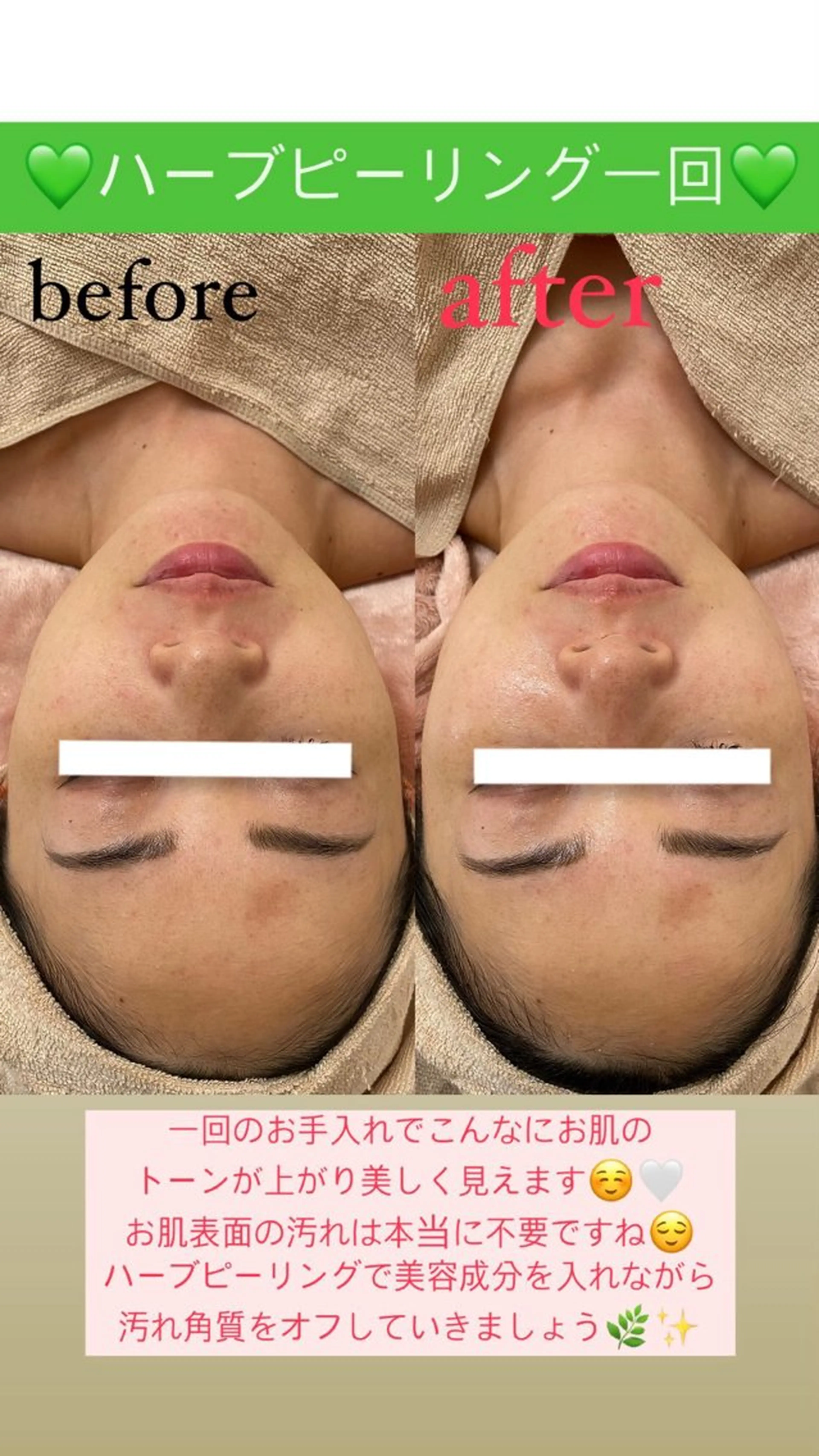 メンズ エステ Salon de Lino 御器所のエステ・リラクイメージ