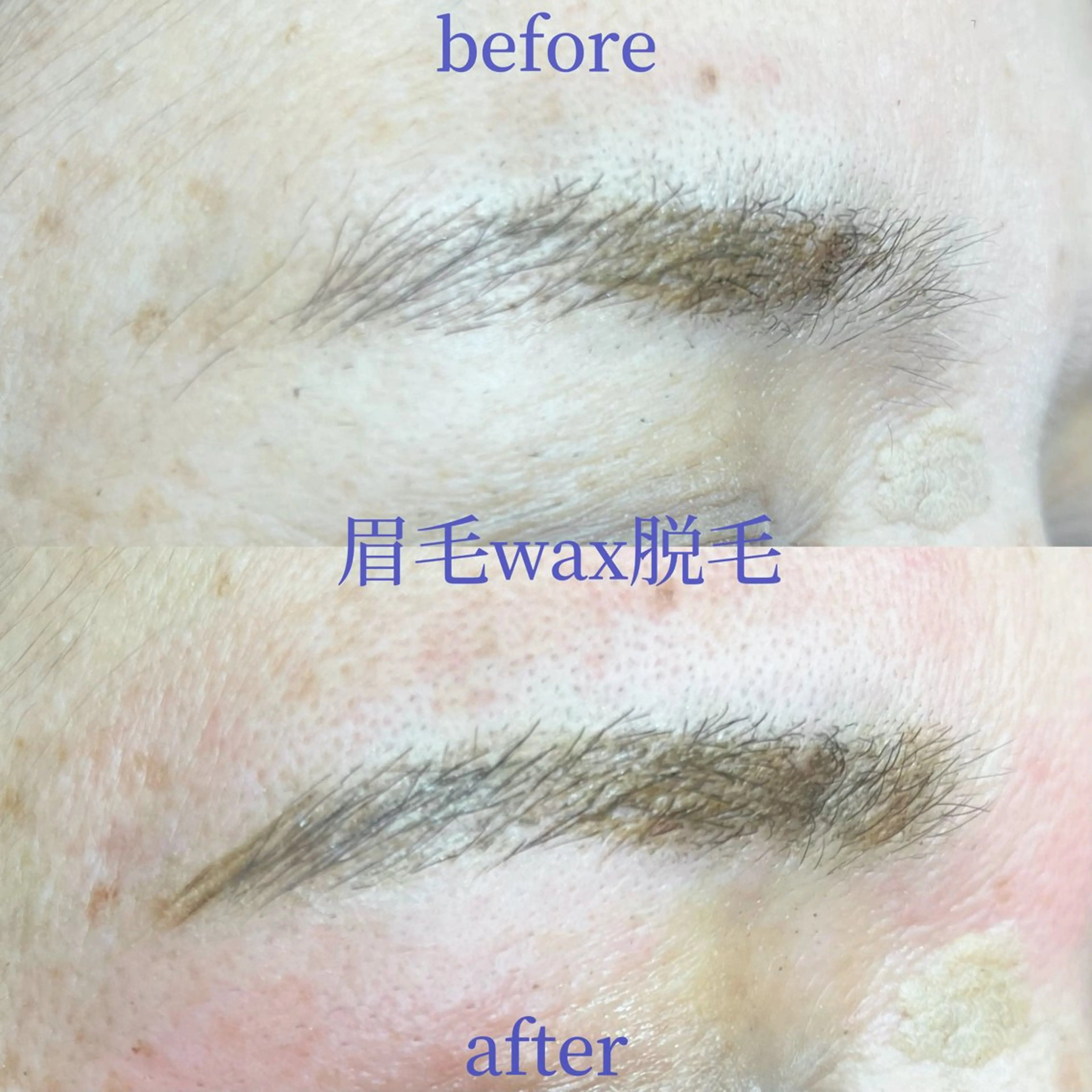 アイブロウ 眉毛ワックス脱毛 ワックス脱毛 若松 絵美のマツエク・マツパデザイン