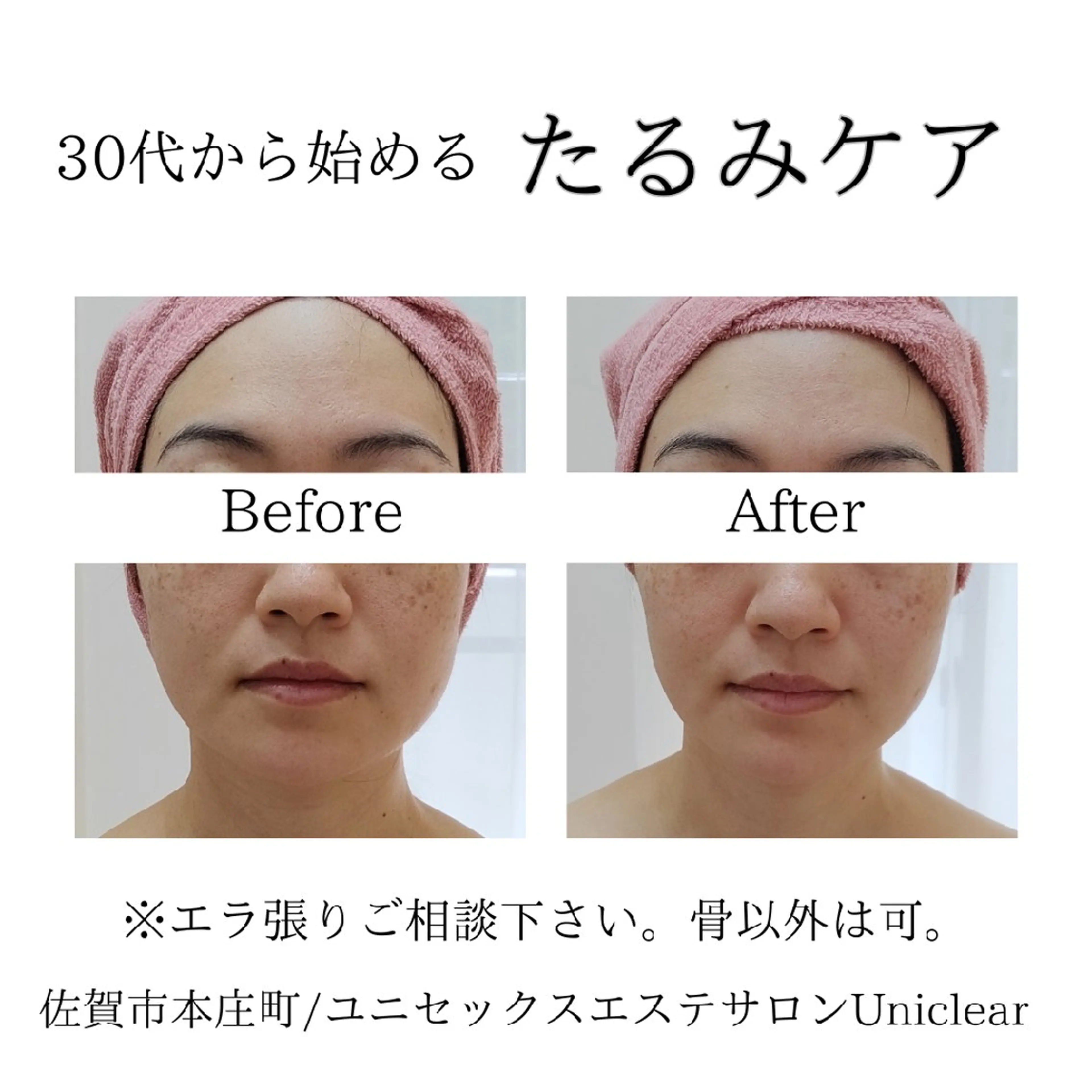 ユニセックスエステサロンUniclear所属・痩身&フェイシャル Uniclearのエステ・リラクイメージ