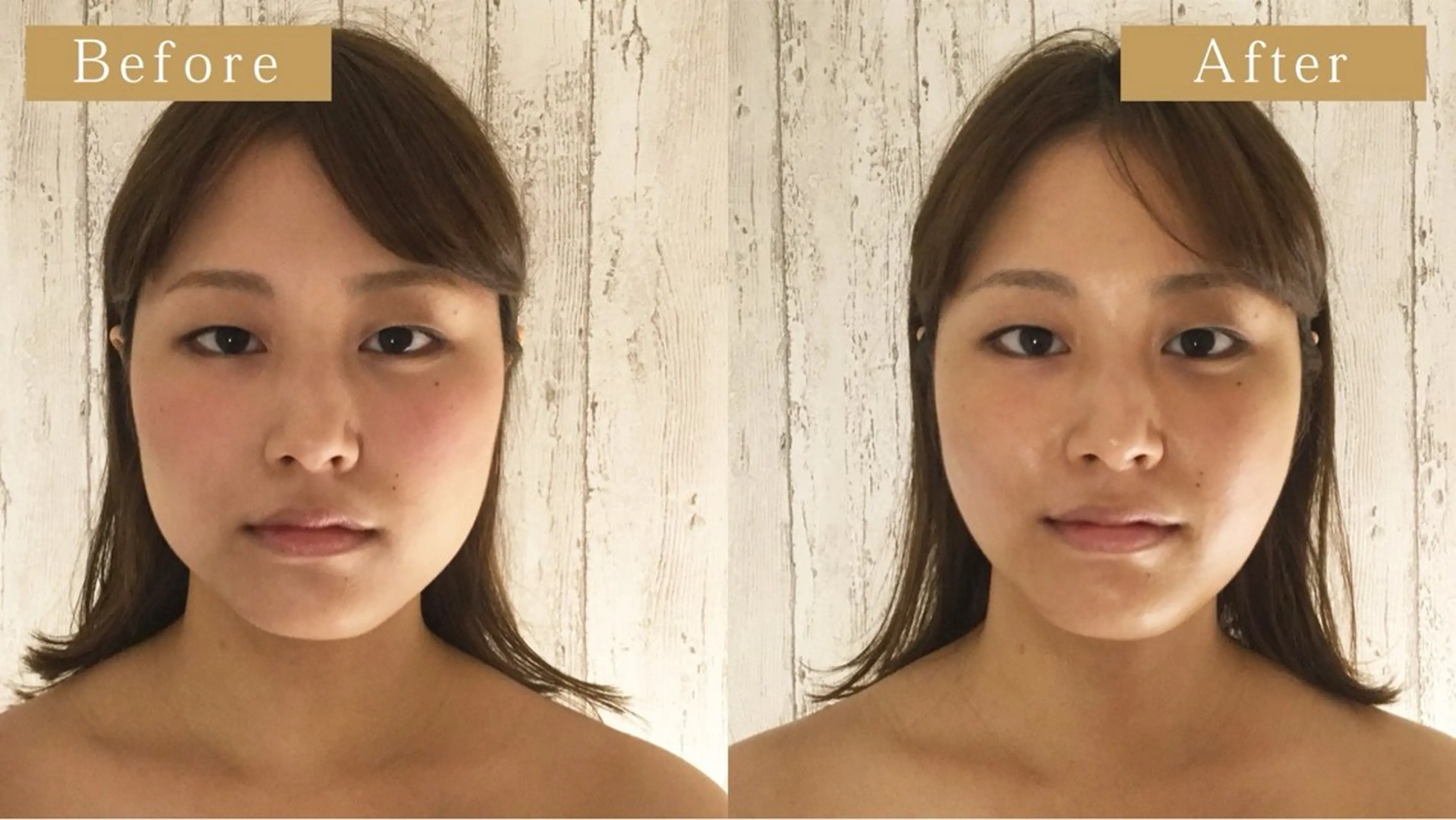 ニキビ･毛穴悩み特化 /CHISATOのエステ・リラクイメージ