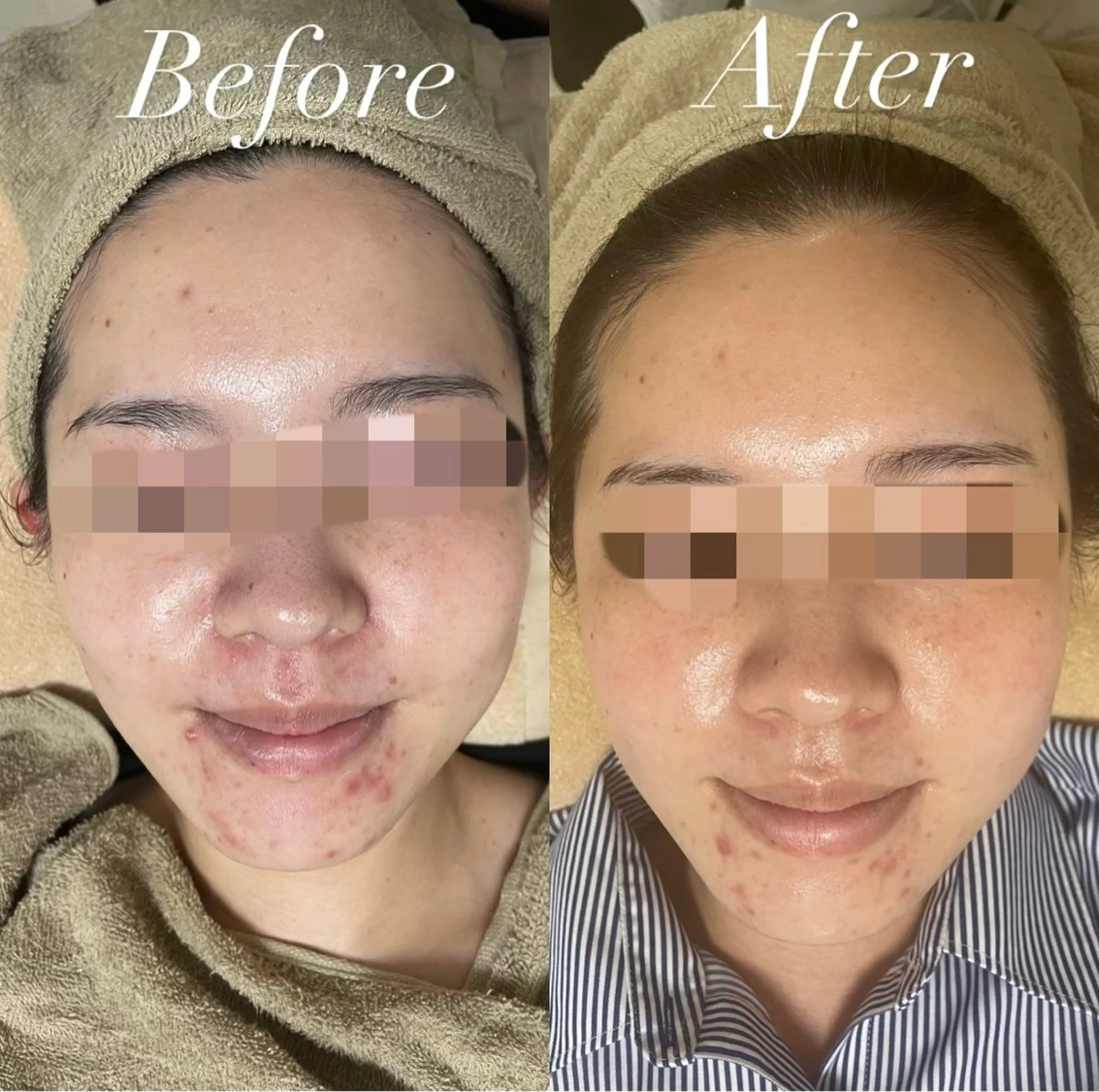 エステ プライベートサロン Belle（ベル）のエステ・リラクイメージ