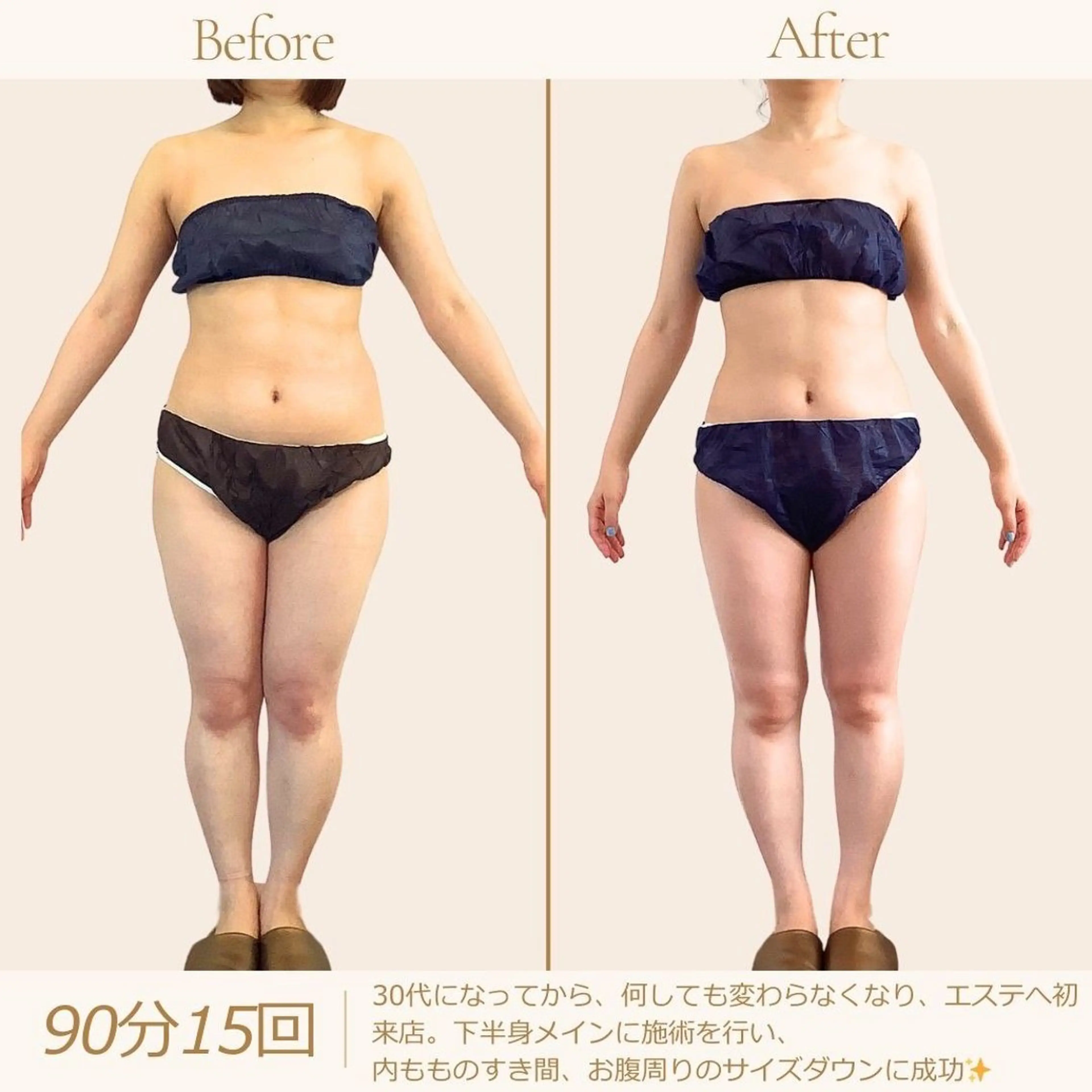 【太もも・ヒップ集中60分】今スグ美脚。脂肪ラジオ波・細胞ナール・筋トレEMSの写真