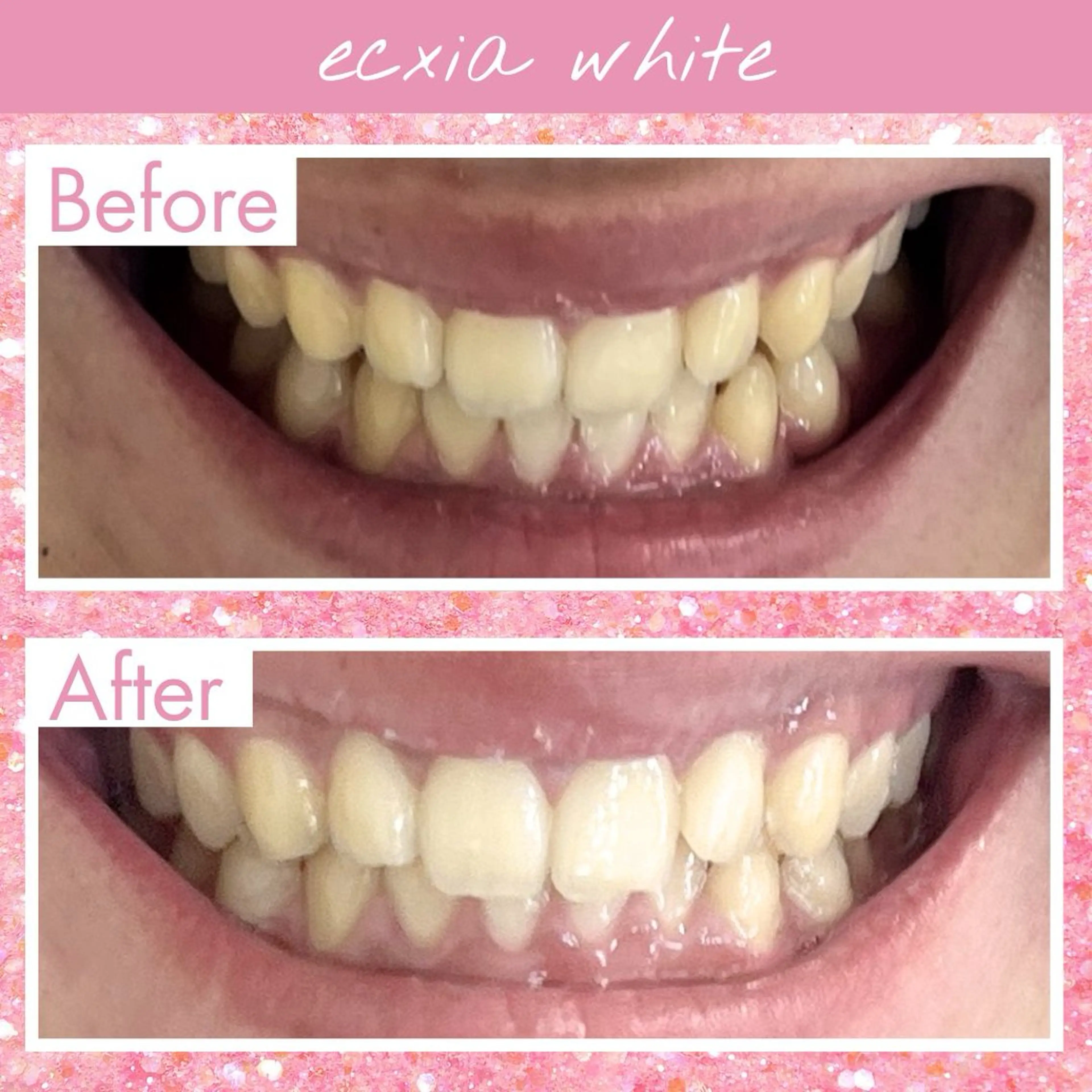 セルフホワイトニング エクシア戸田公園店所属・セルフホワイトニング エクシア戸田公園店のその他イメージ