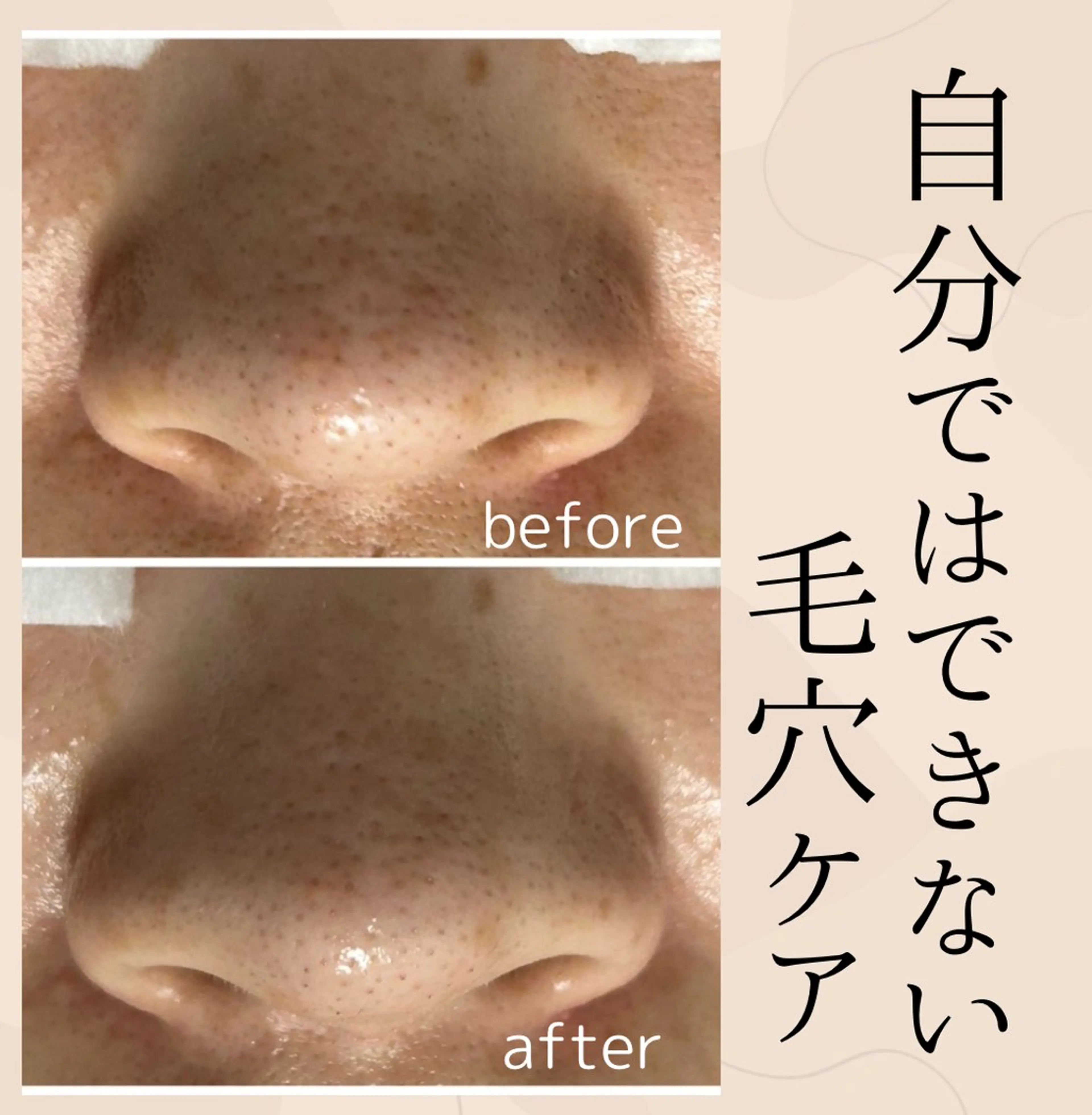 エステ 小顔・毛穴・たるみ ネイル　似内真樹のエステ・リラクイメージ