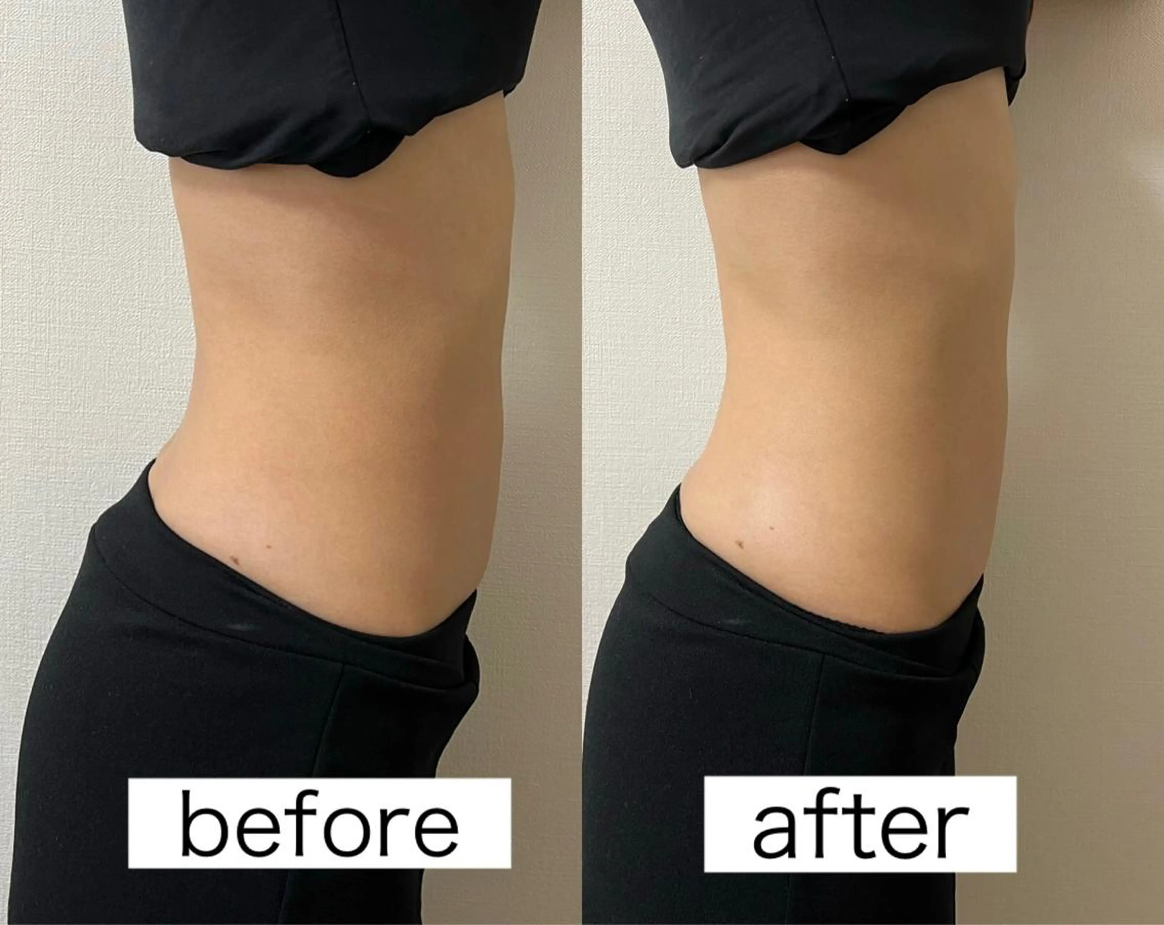 Beauty   Salon  Adiy所属・Adiy ikumiのエステ・リラクイメージ