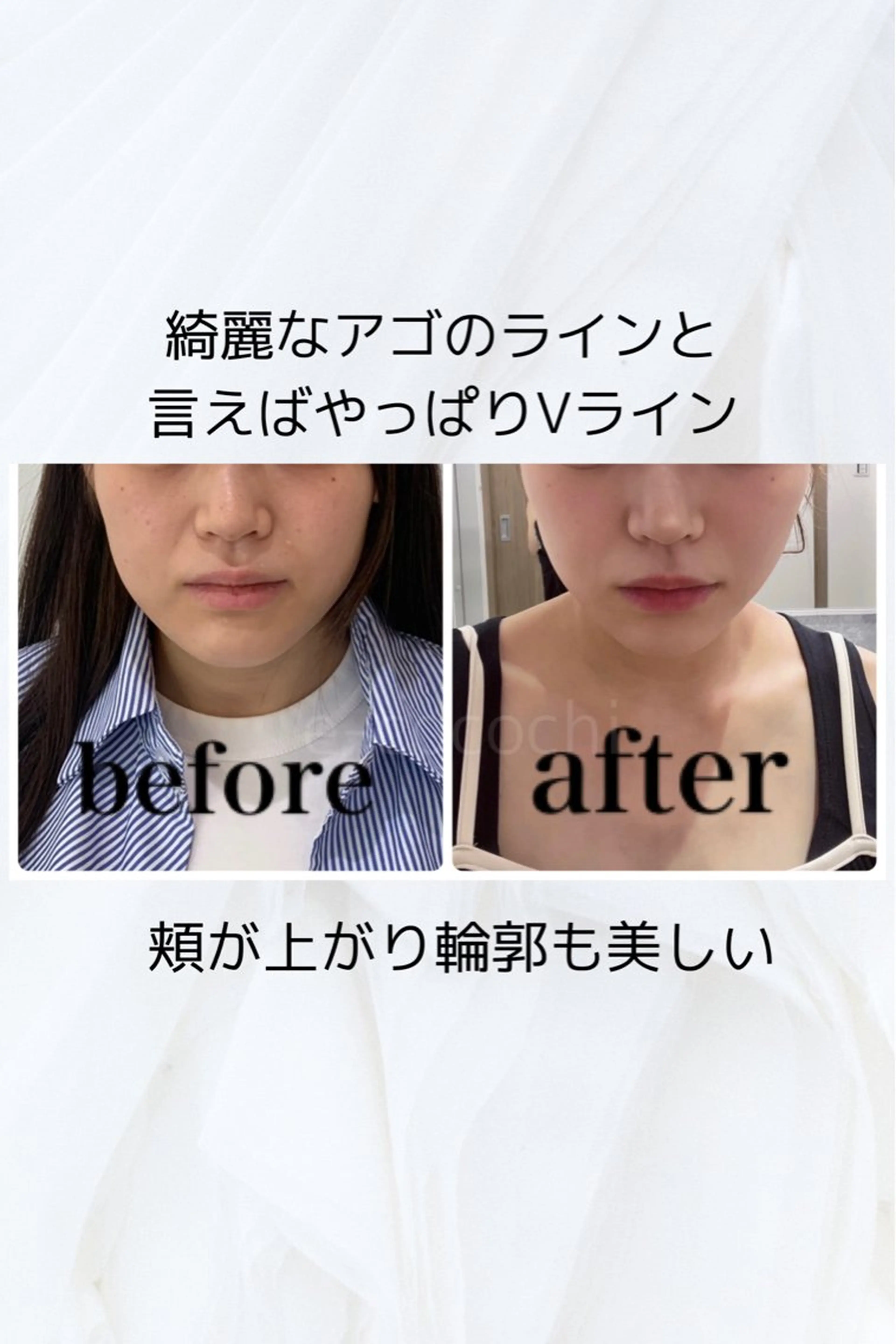 エステ リラク 小顔と ヘッドスパのお店のエステ・リラクイメージ